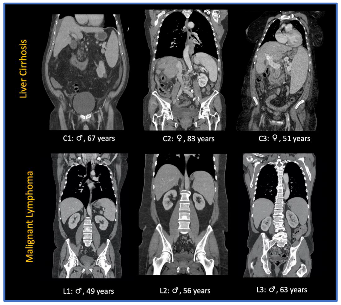 Cancers 14 05476 g002