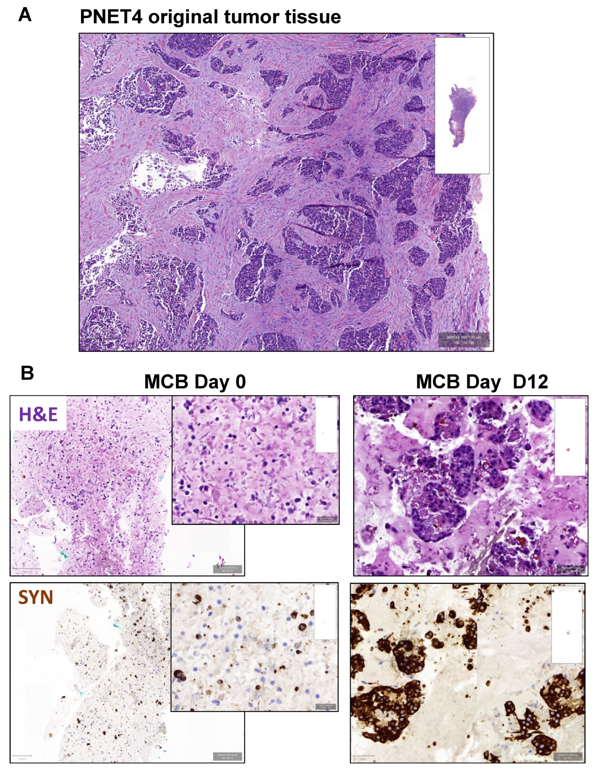 Cancers 14 05481 g008a Cancers 14 05481 g008a