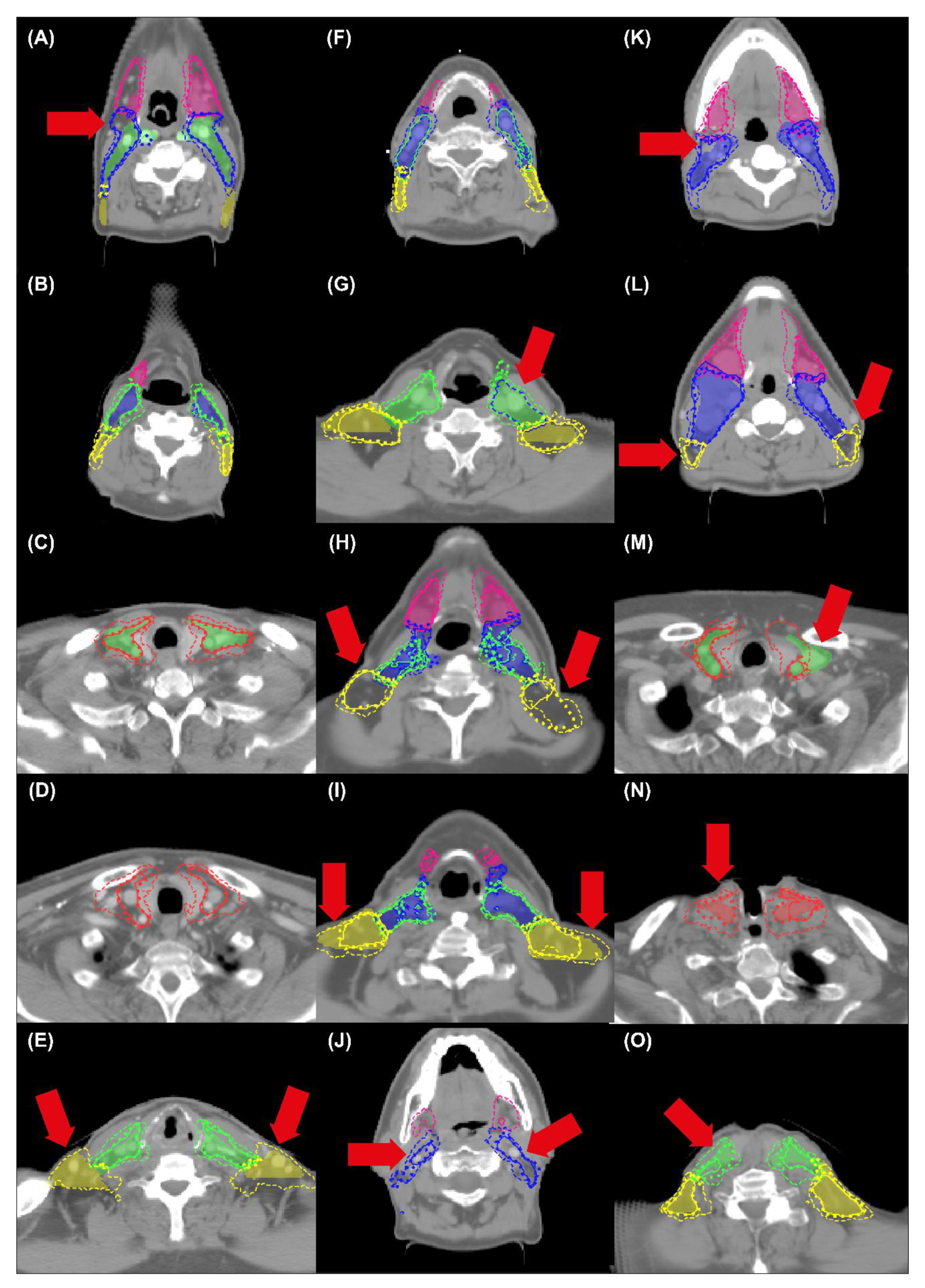 Cancers 14 05501 g006 Cancers 14 05501 g006