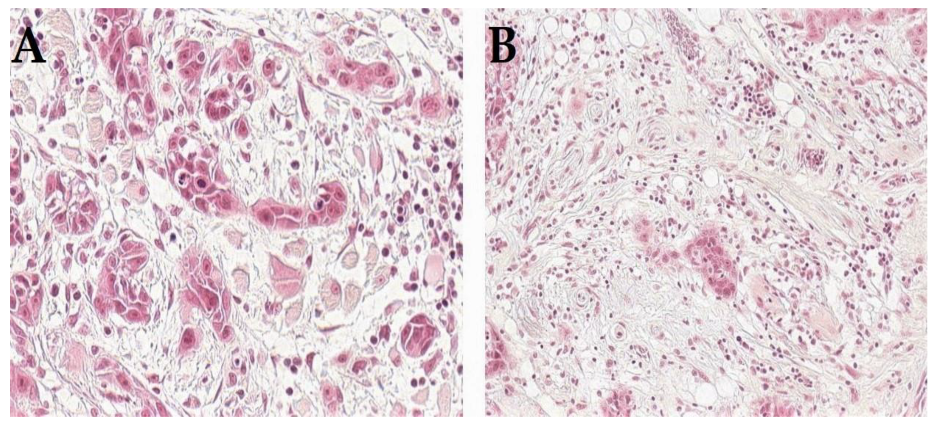 Cancers 14 05514 g001