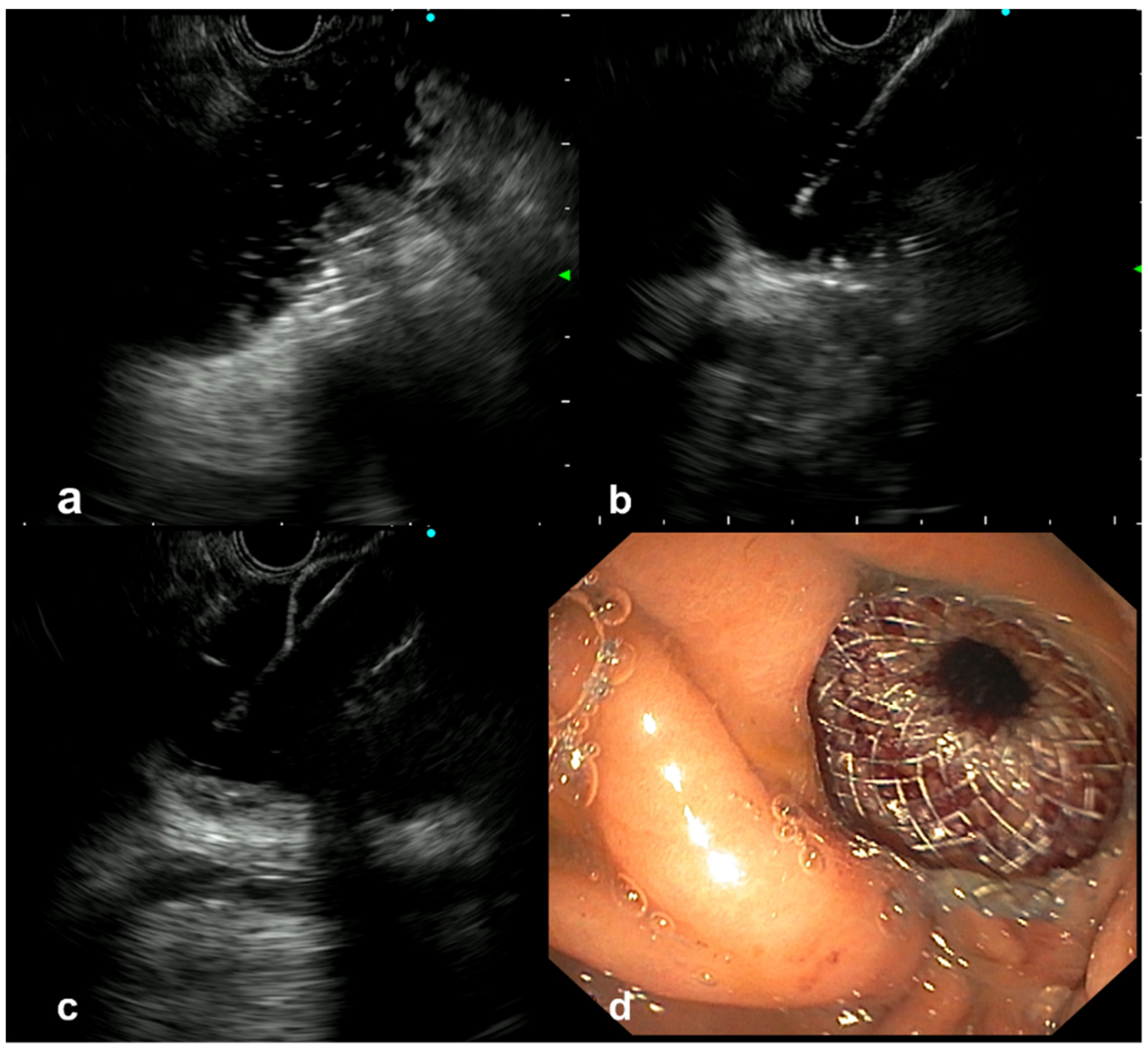 Cancers 14 05516 g001 550