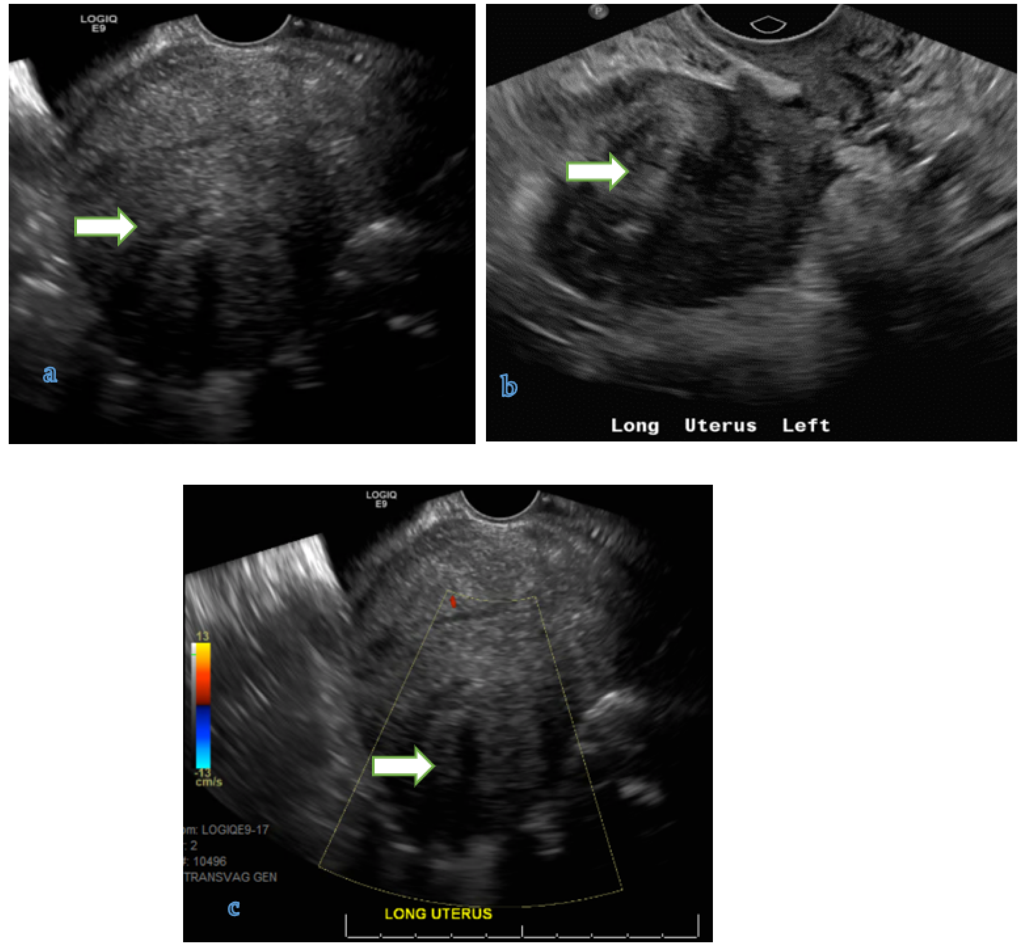 Cancers 14 05528 g001 Cancers 14 05528 g001