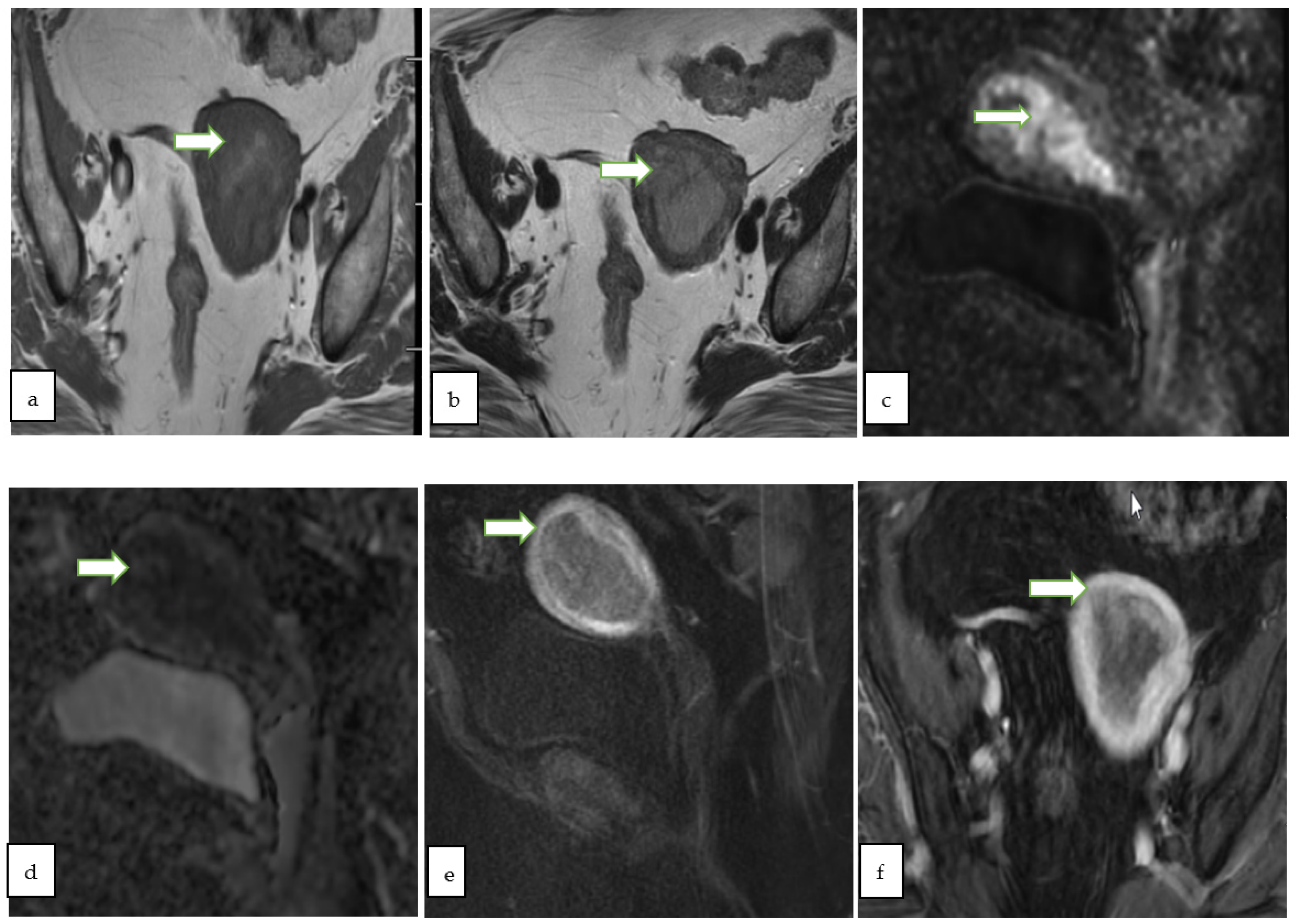 Cancers 14 05528 g005 Cancers 14 05528 g005