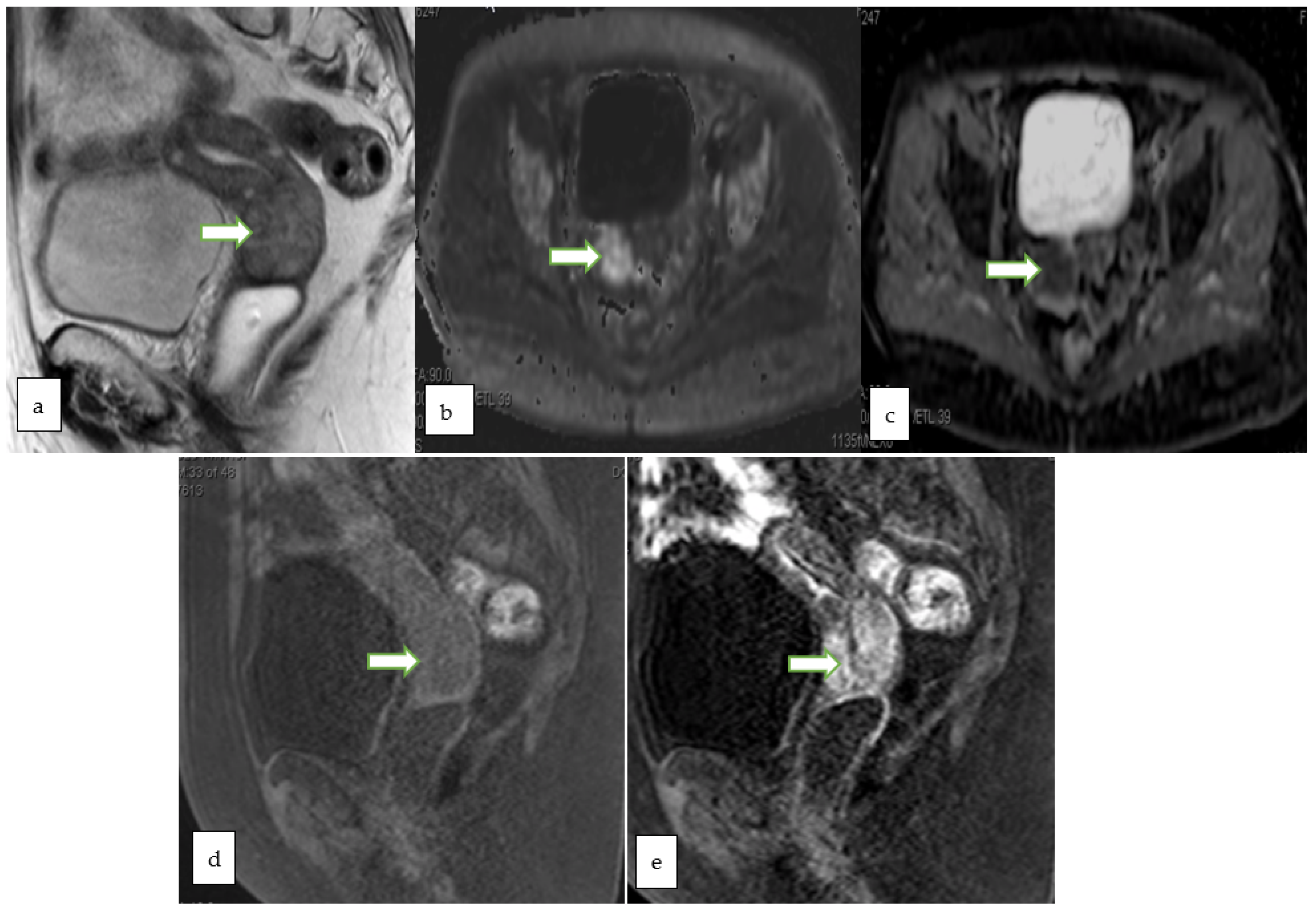 Cancers 14 05528 g006 Cancers 14 05528 g006