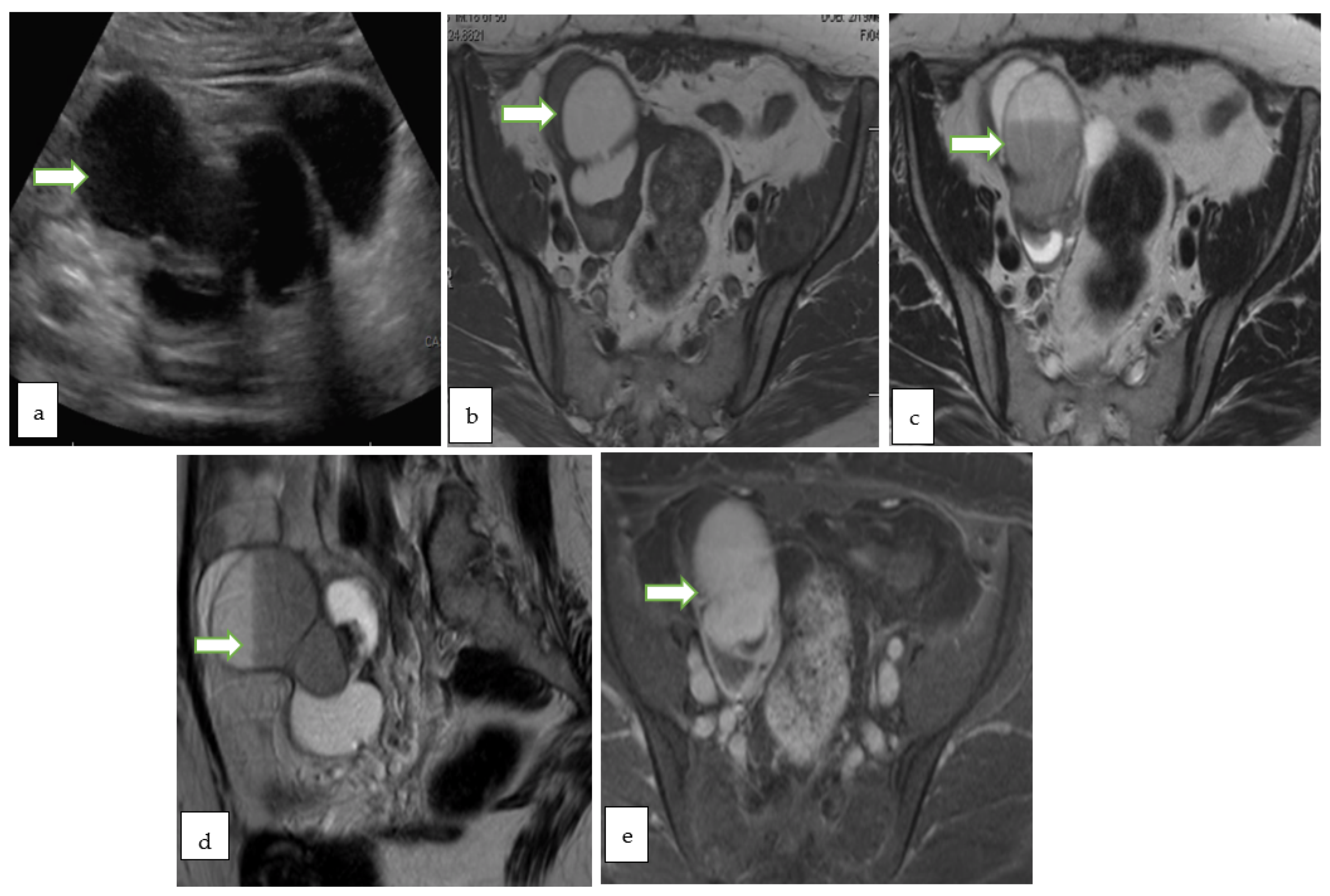 Cancers 14 05528 g008 Cancers 14 05528 g008