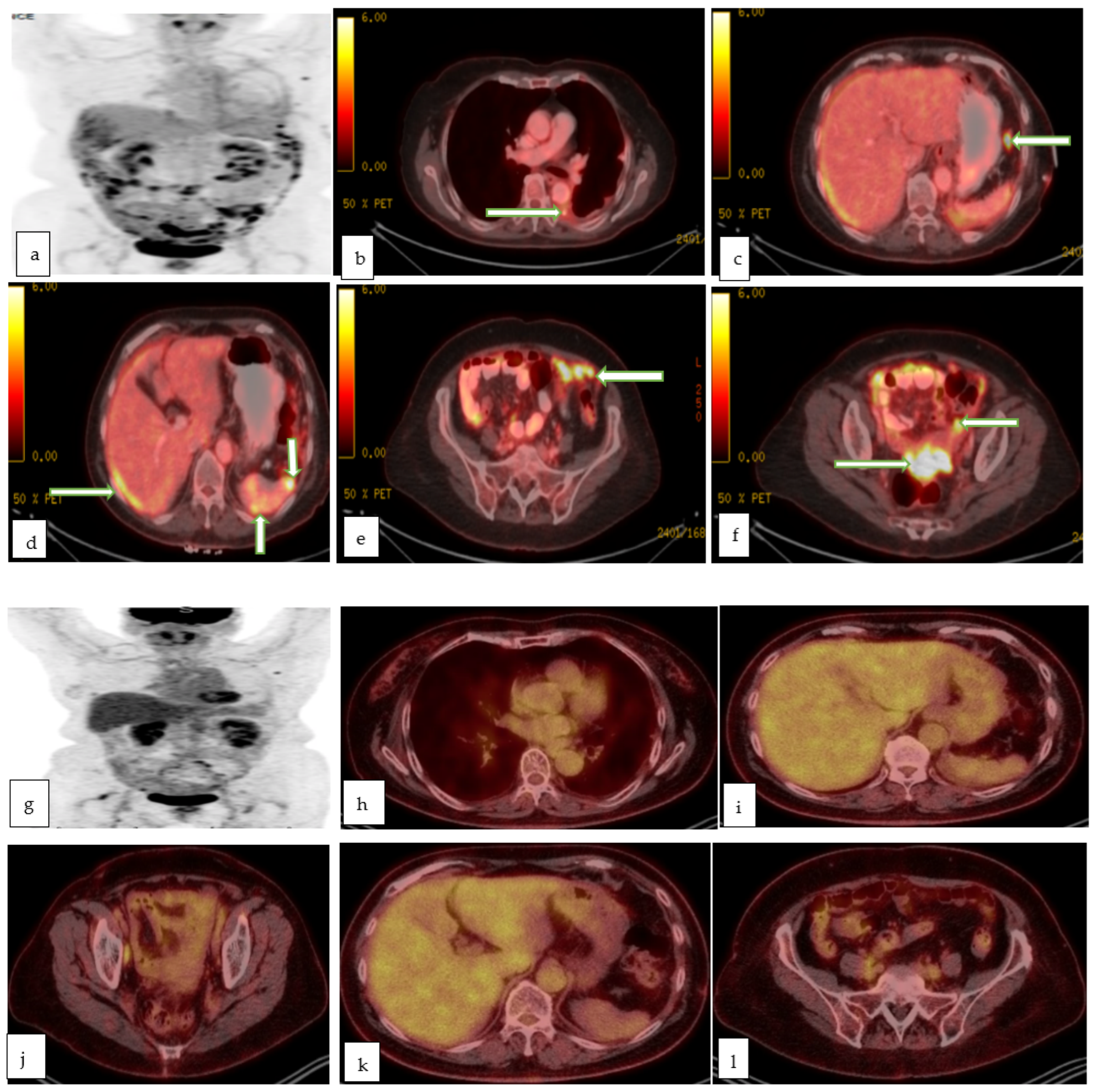 Cancers 14 05528 g010 Cancers 14 05528 g010