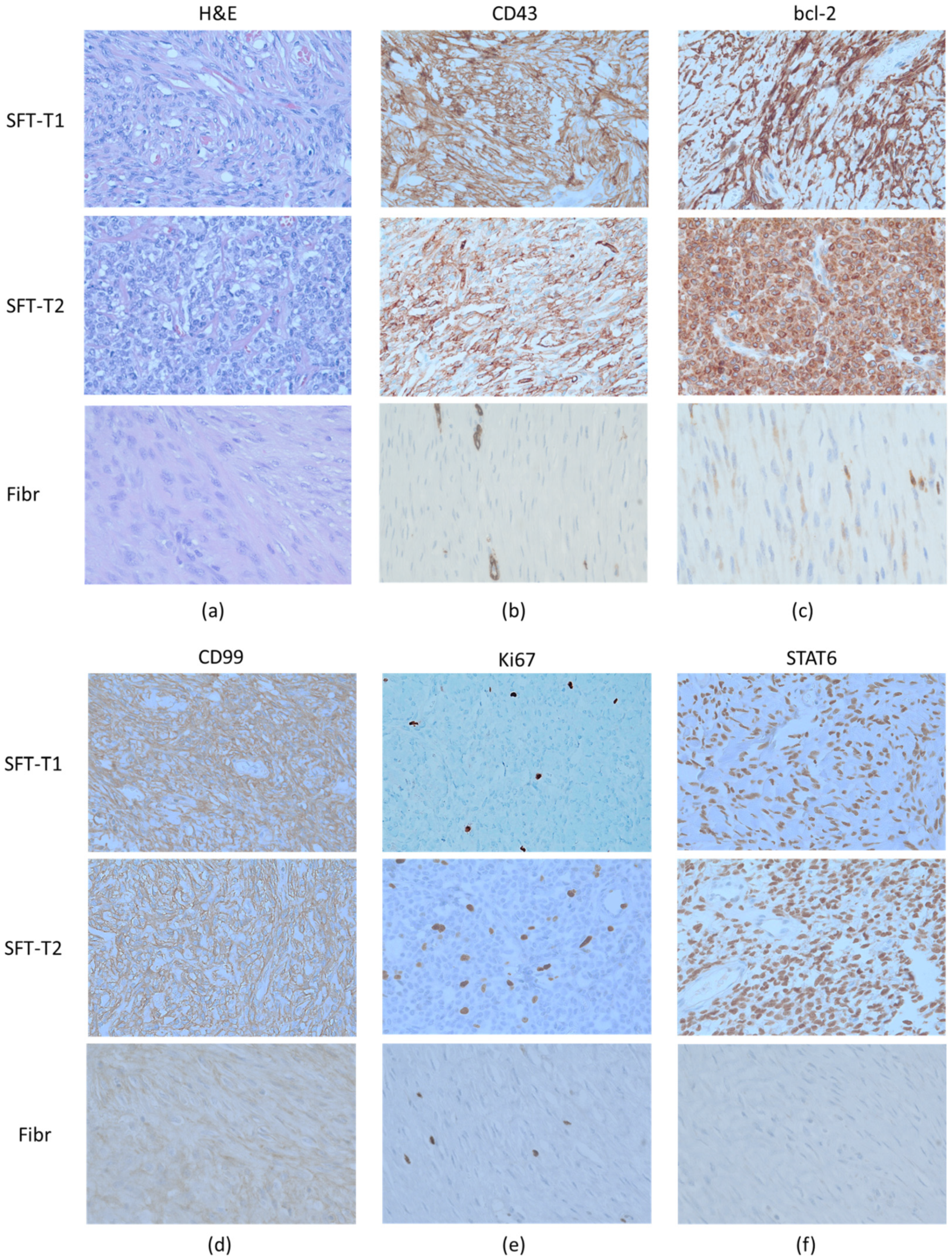 Cancers 14 05602 g002 Cancers 14 05602 g002