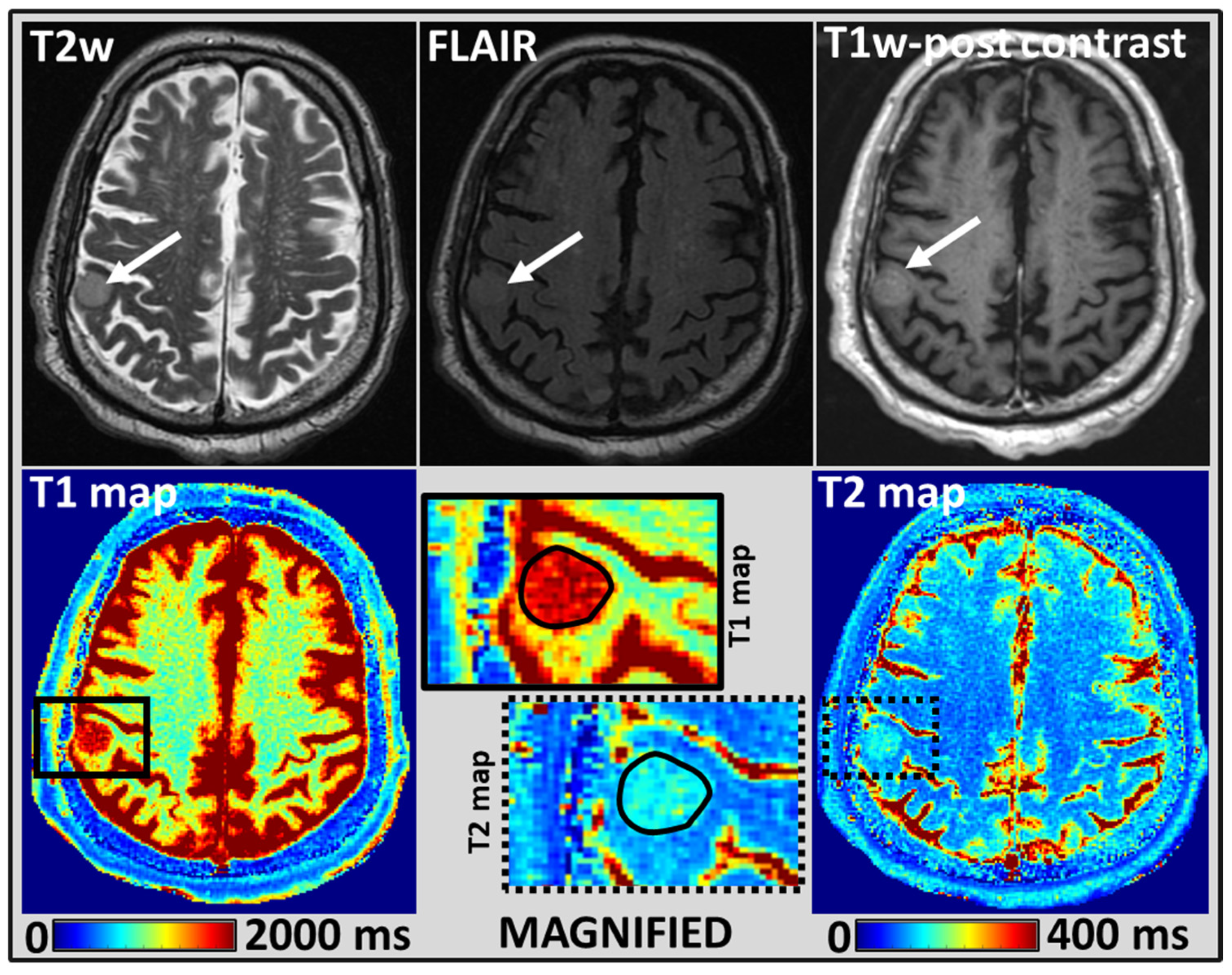 Cancers 14 05606 g002 Cancers 14 05606 g002