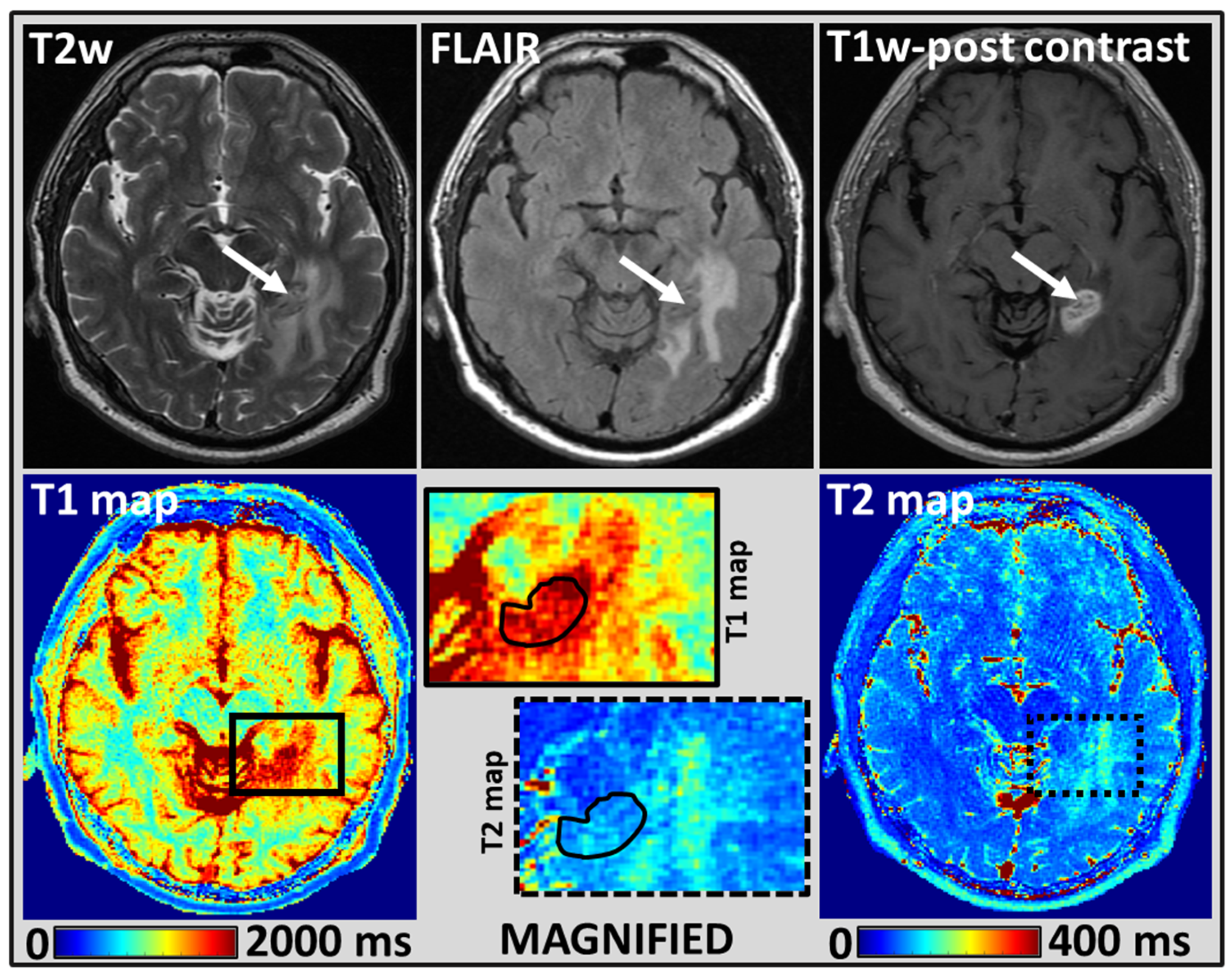 Cancers 14 05606 g003 Cancers 14 05606 g003