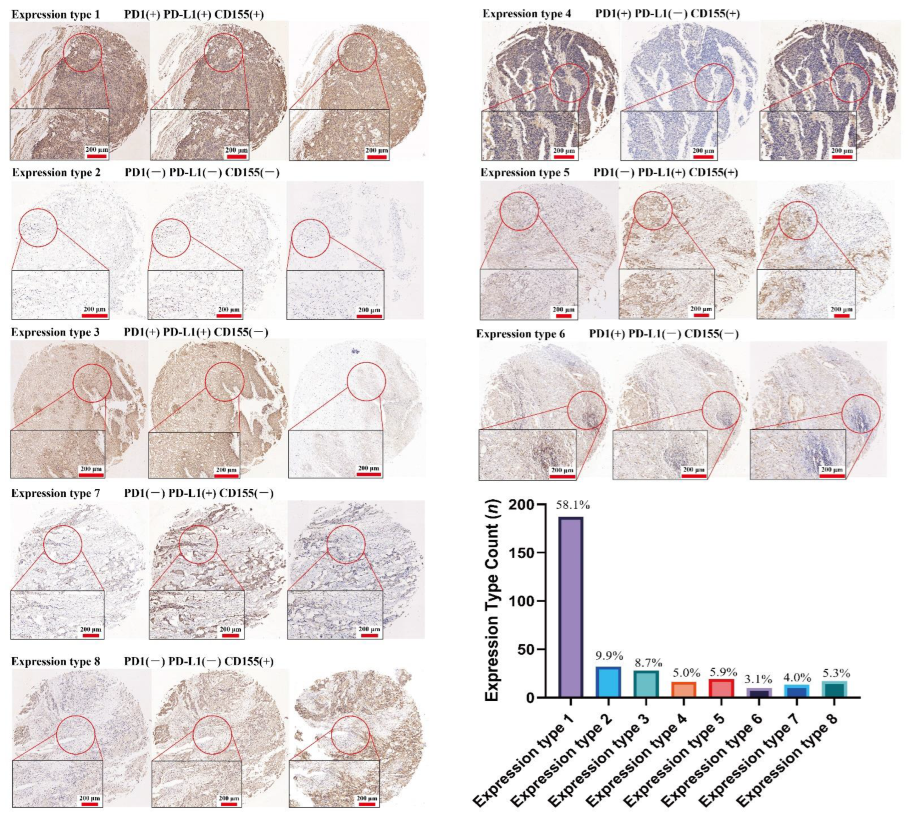 Cancers 14 05610 g006