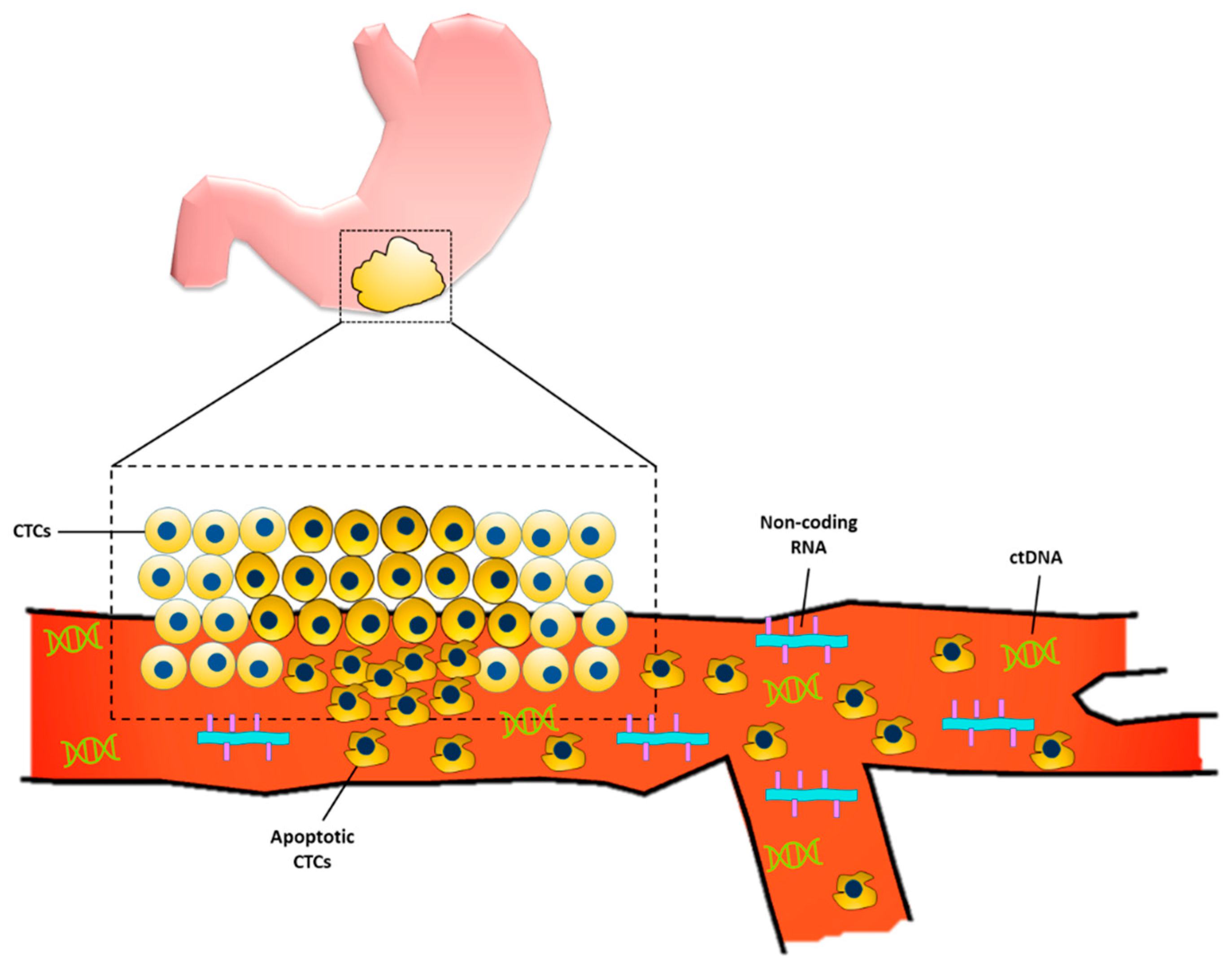 Ai Shinozaki Big Tits - Cancers | Free Full-Text | Recent Trends and Advancements in the Diagnosis  and Management of Gastric Cancer