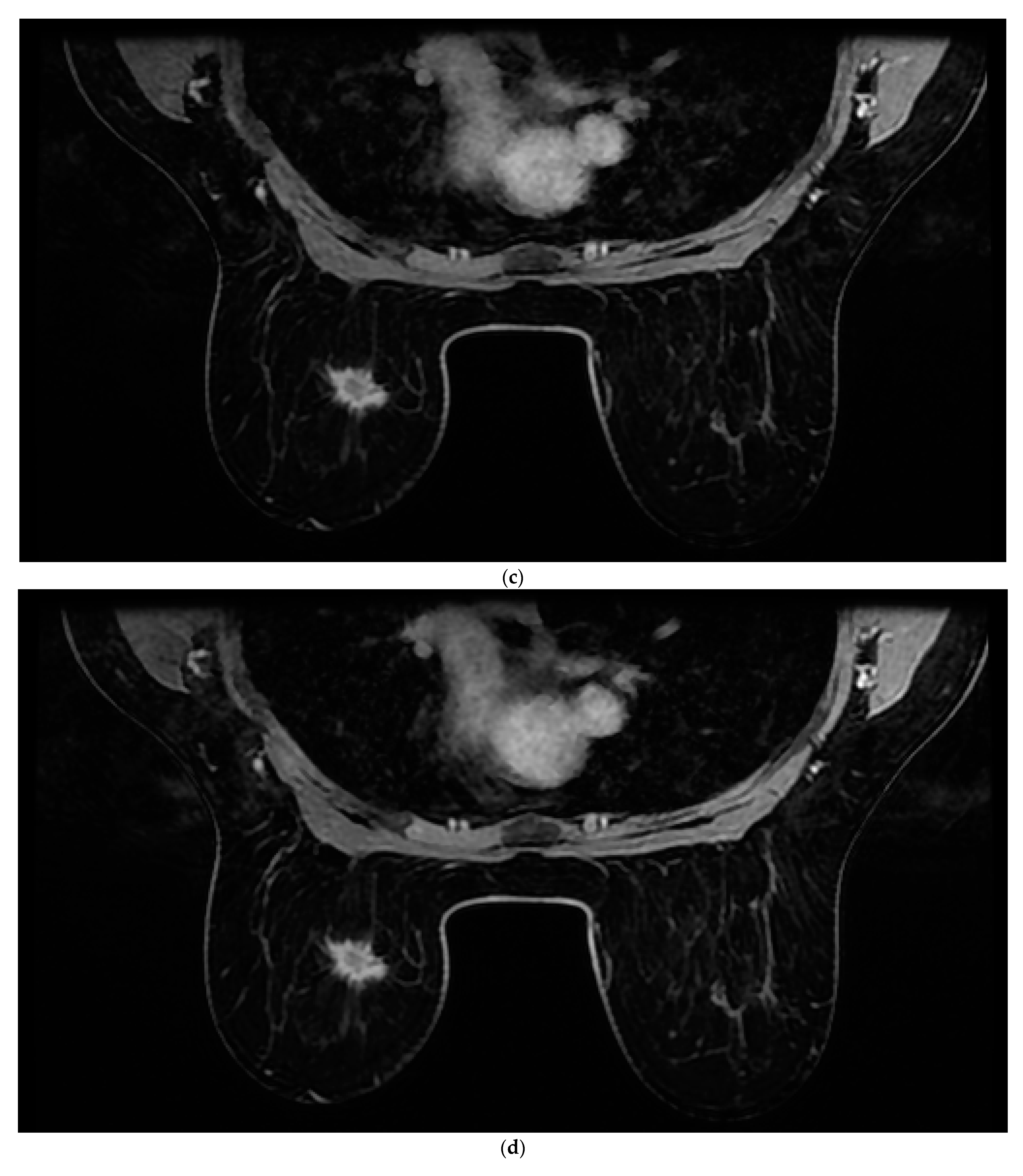 Cancers 14 05645 g001b