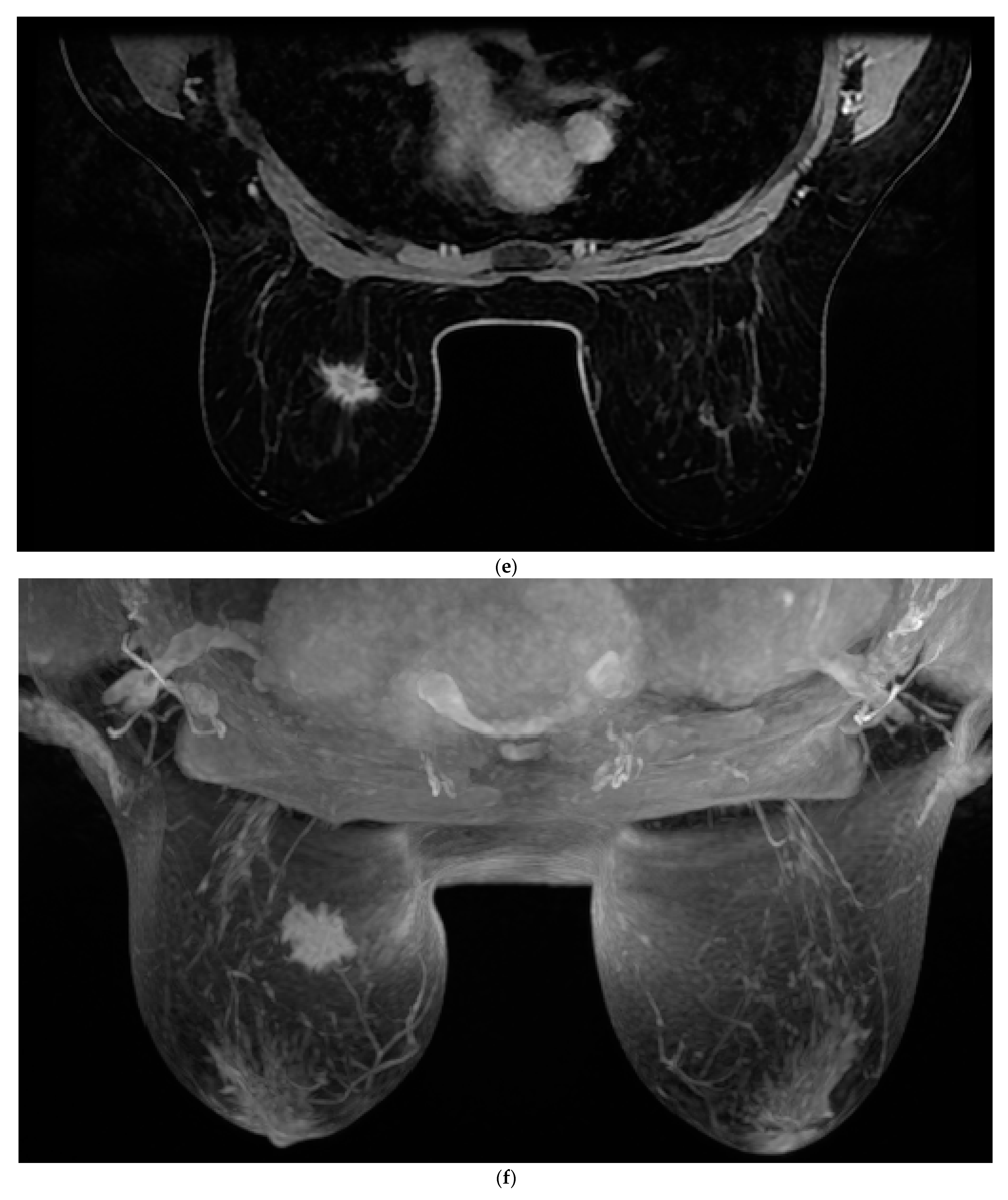 Cancers 14 05645 g001c