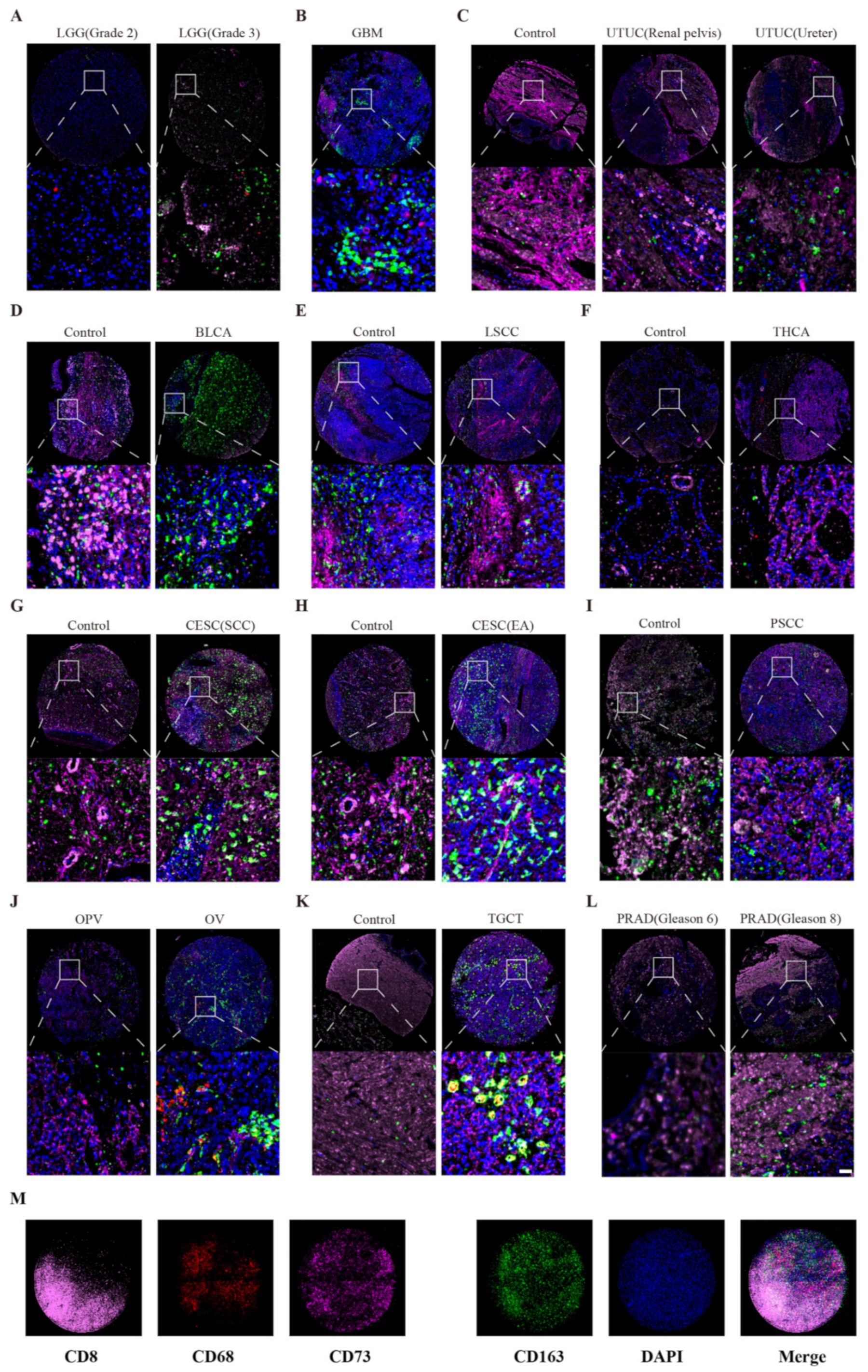 Cancers 14 05663 g007