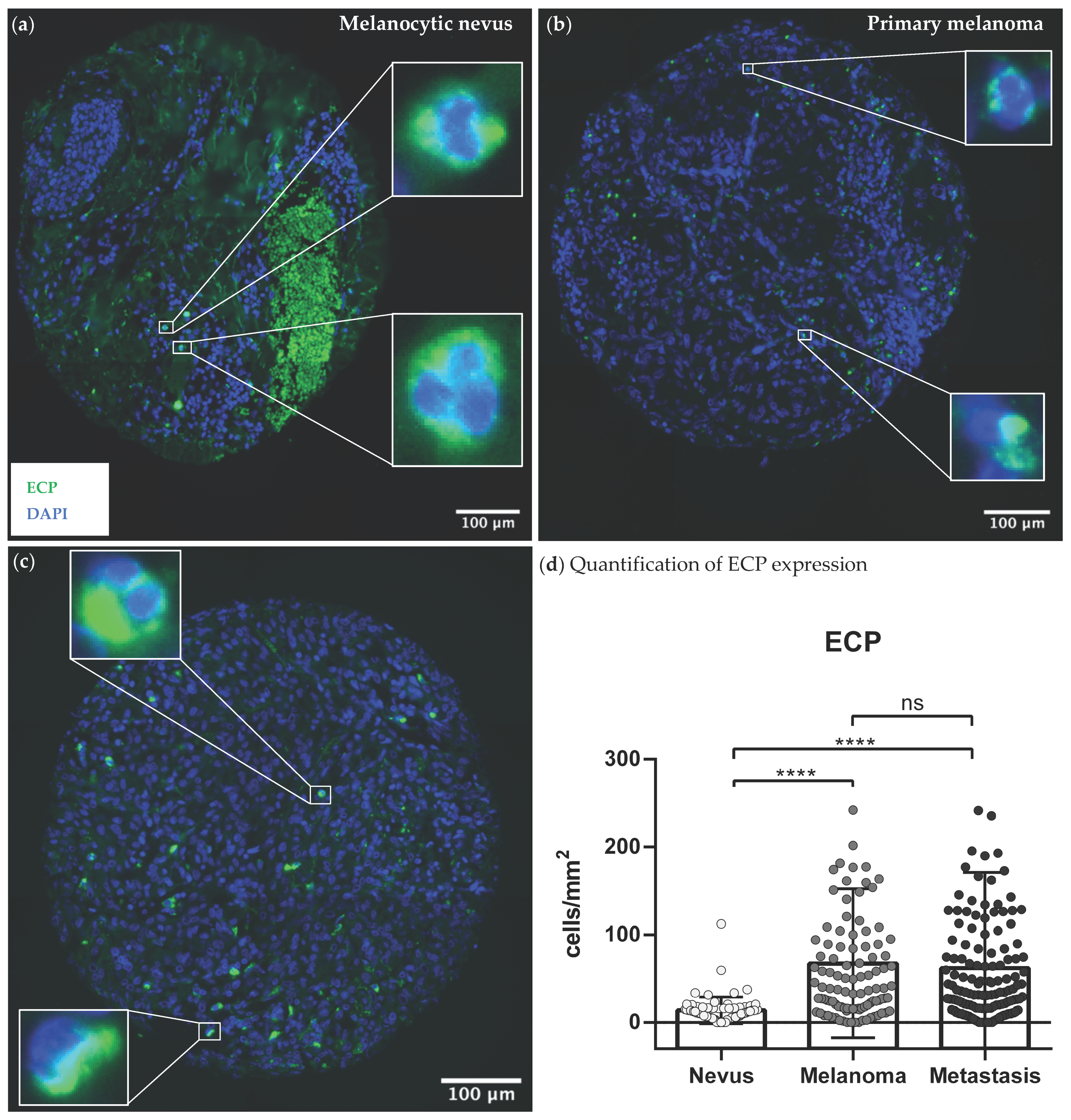 Cancers 14 05676 g001 Cancers 14 05676 g001