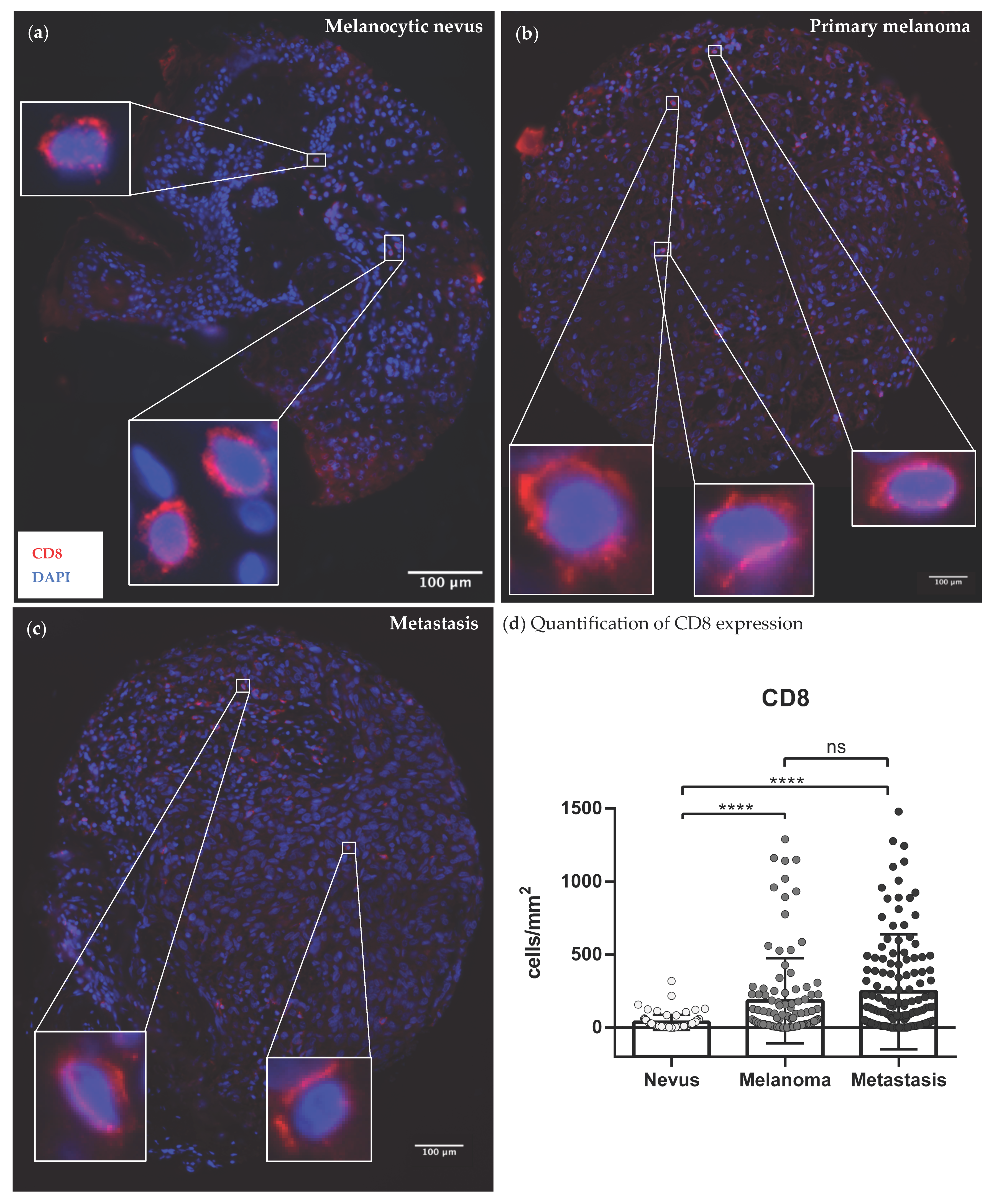 Cancers 14 05676 g002 Cancers 14 05676 g002