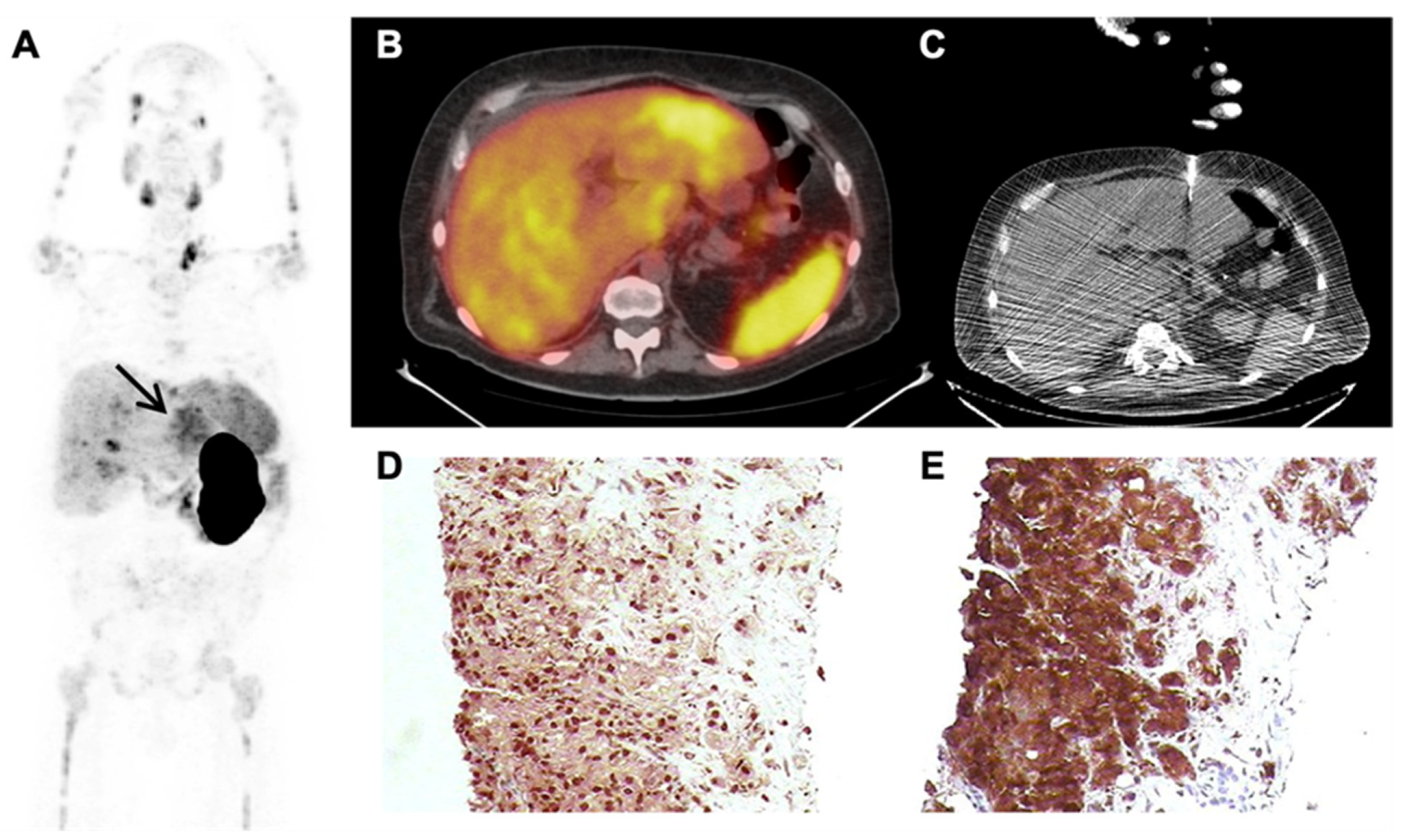 Cancers 14 05680 g002 Cancers 14 05680 g002