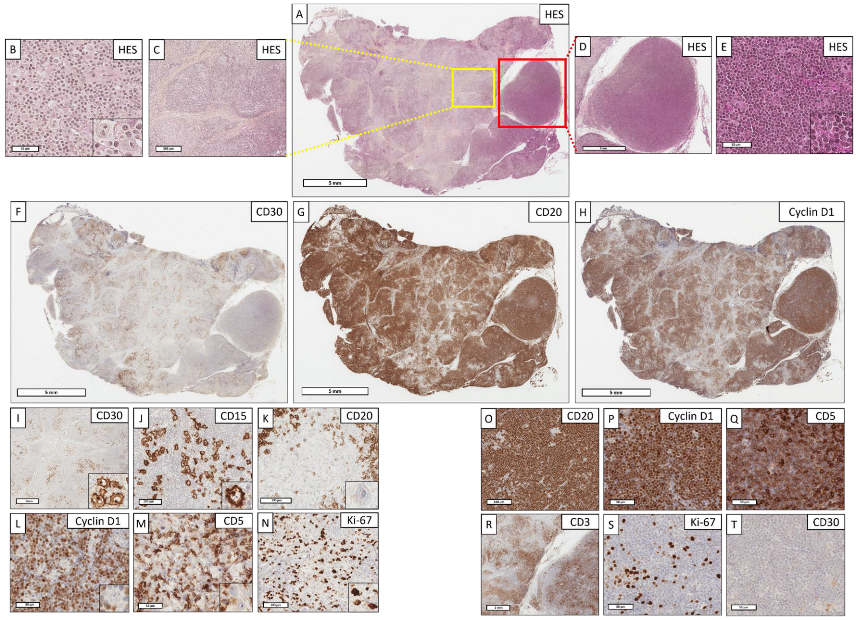 Cancers 14 05695 g002 Cancers 14 05695 g002