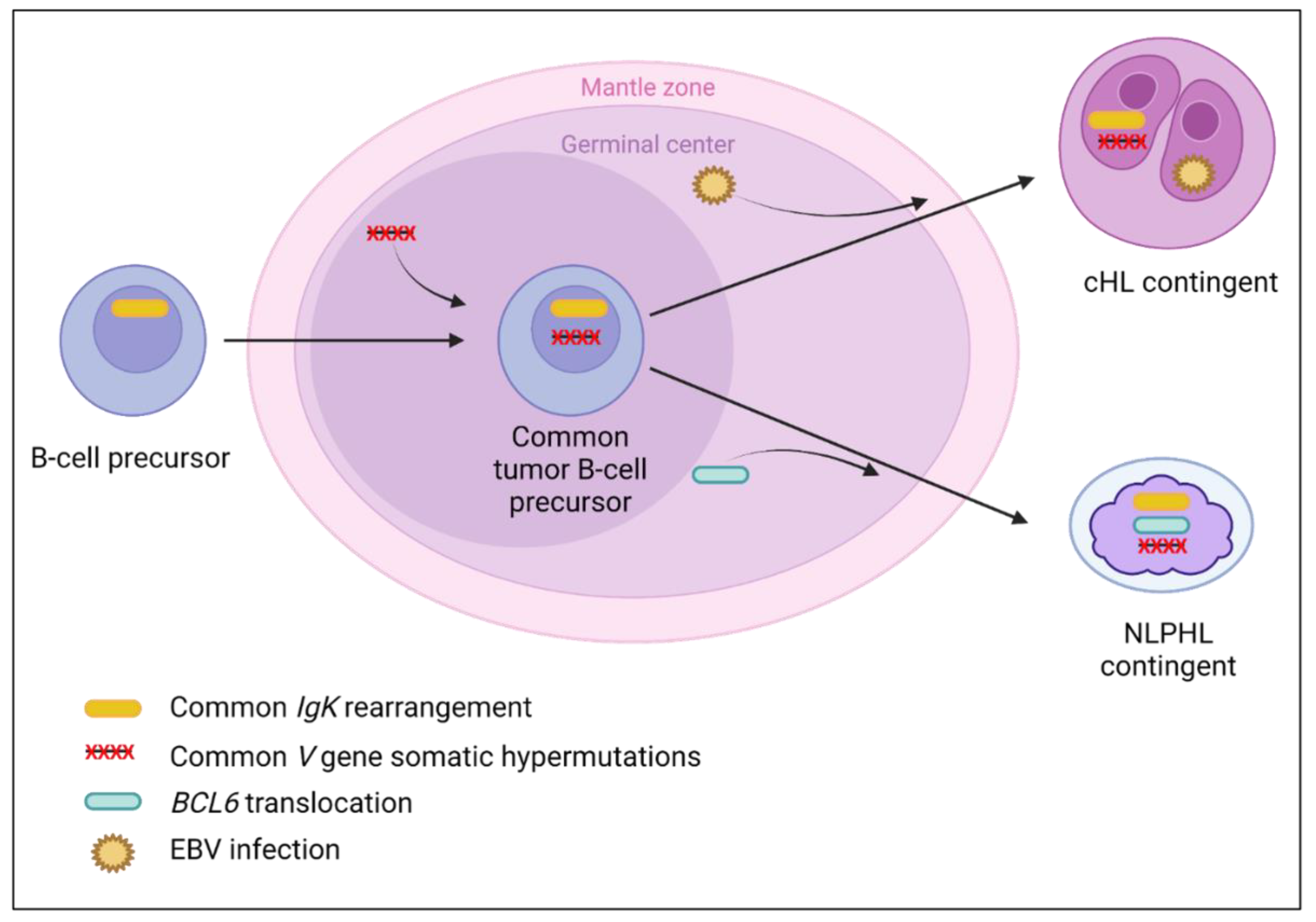 Plasticity in Classical Hodgkin Composite Lymphomas: A Plasticity in Classical Hodgkin Composite Lymphomas: A
