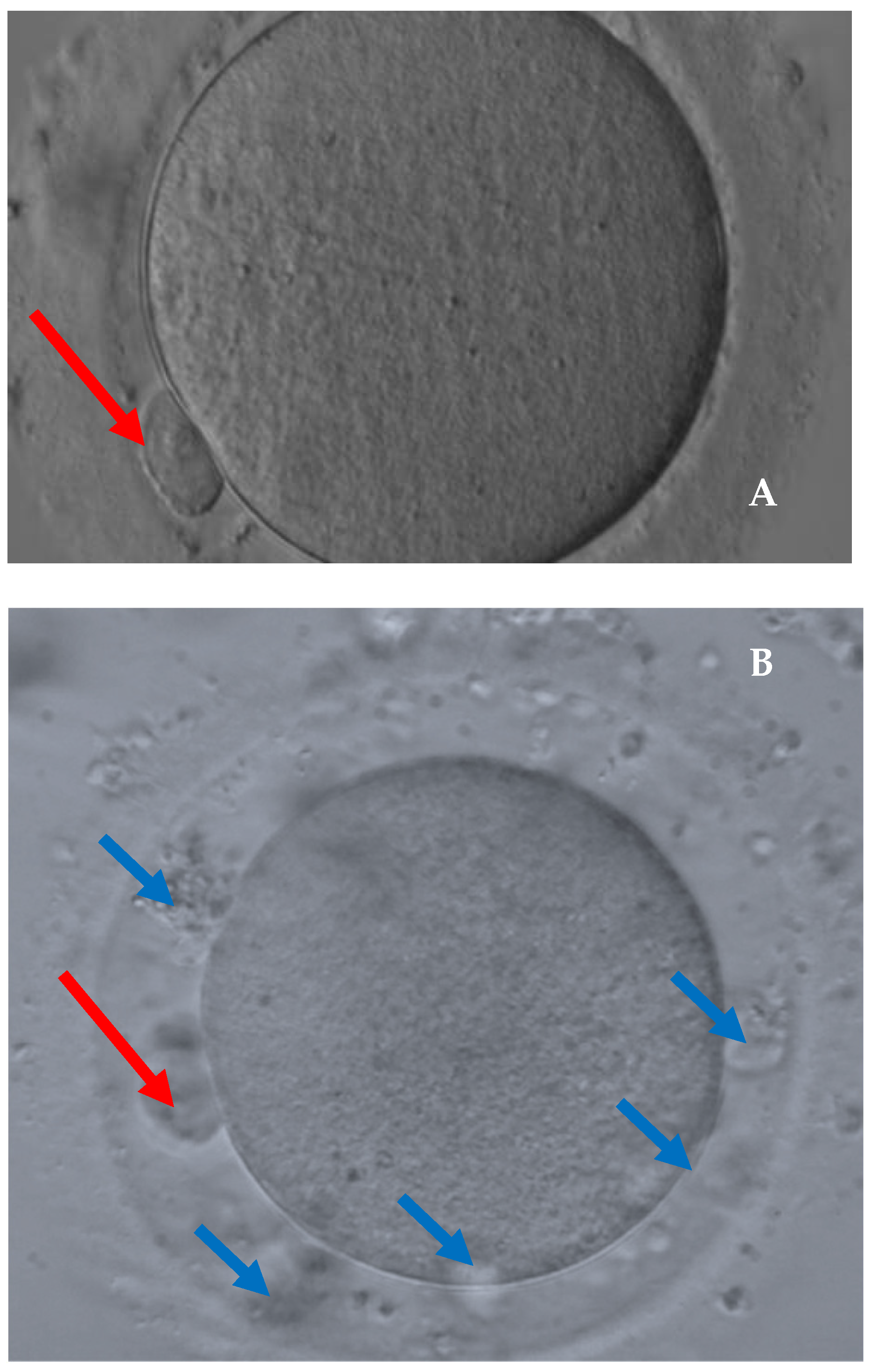 Cancers 14 05718 g002 Cancers 14 05718 g002