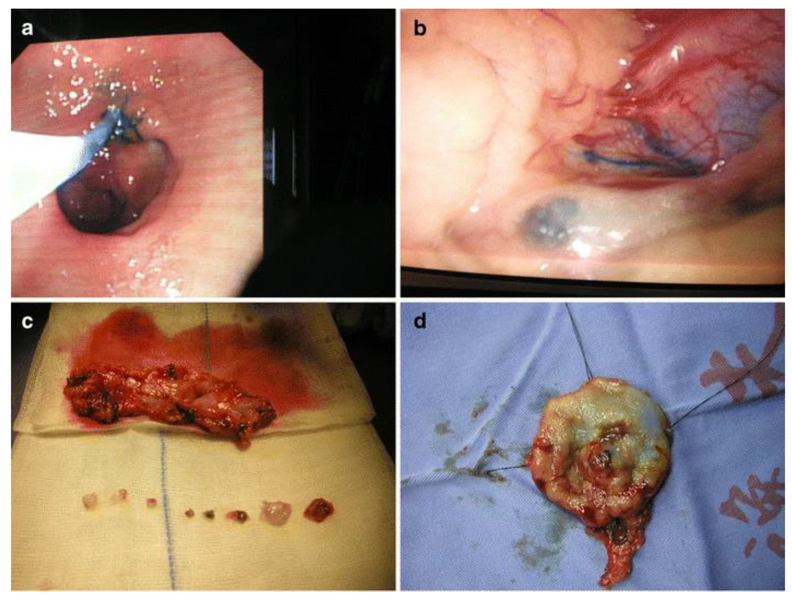 Cancers 14 05735 g001 Cancers 14 05735 g001