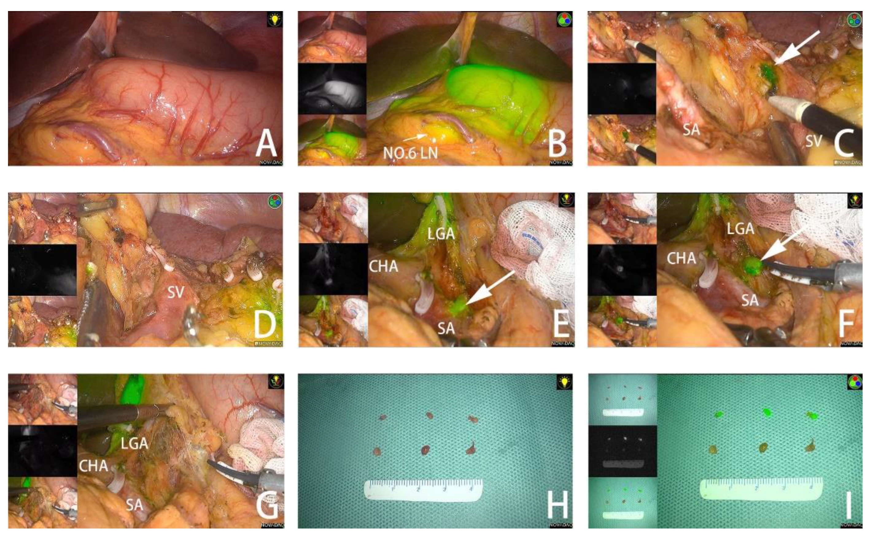 Cancers 14 05735 g002 Cancers 14 05735 g002