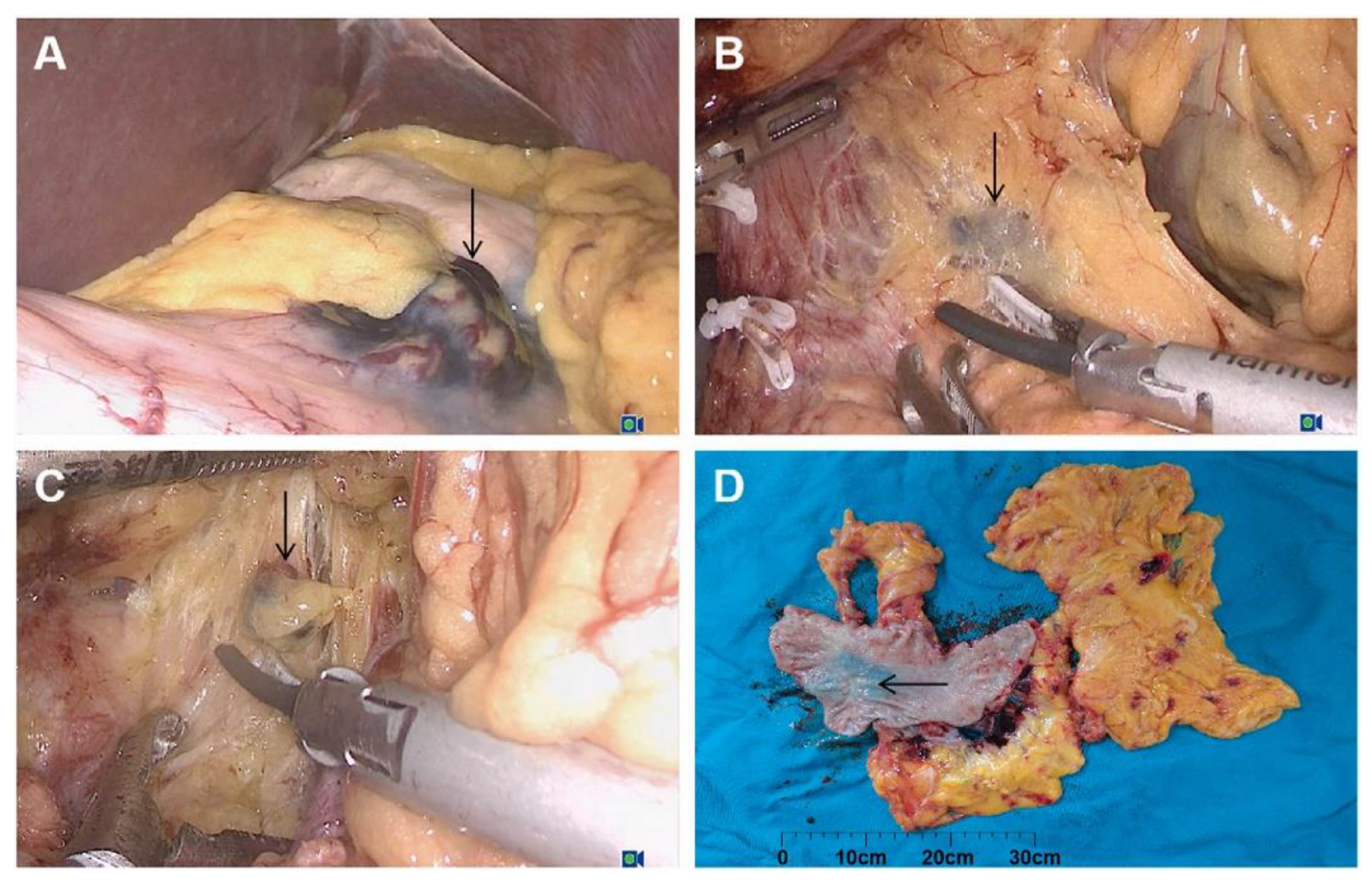 Cancers 14 05735 g003 Cancers 14 05735 g003