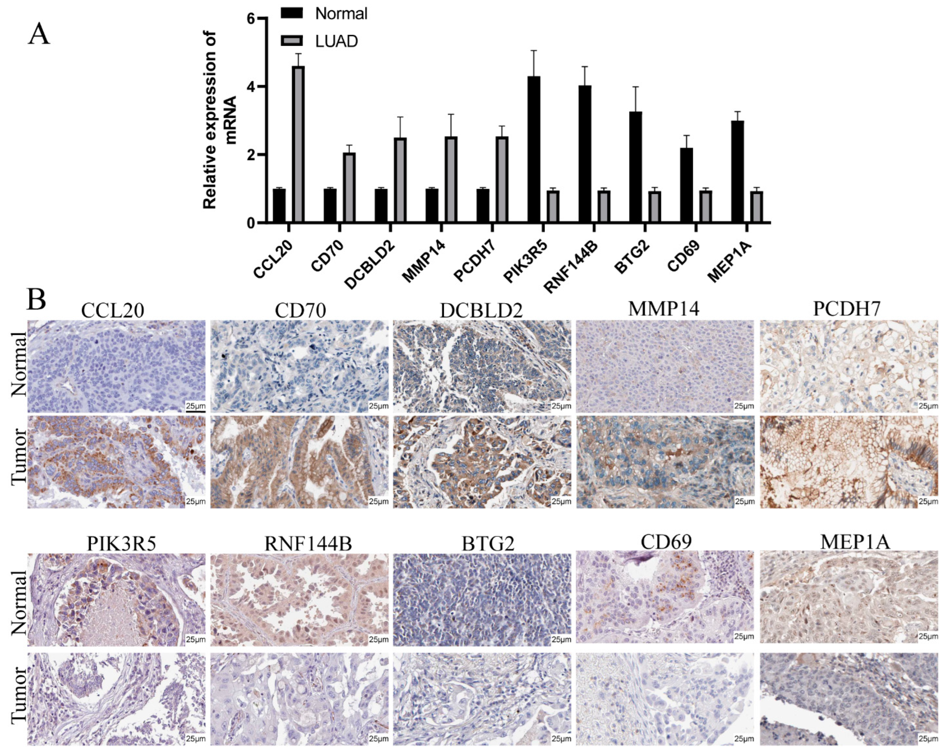 Cancers 14 05744 g009 Cancers 14 05744 g009