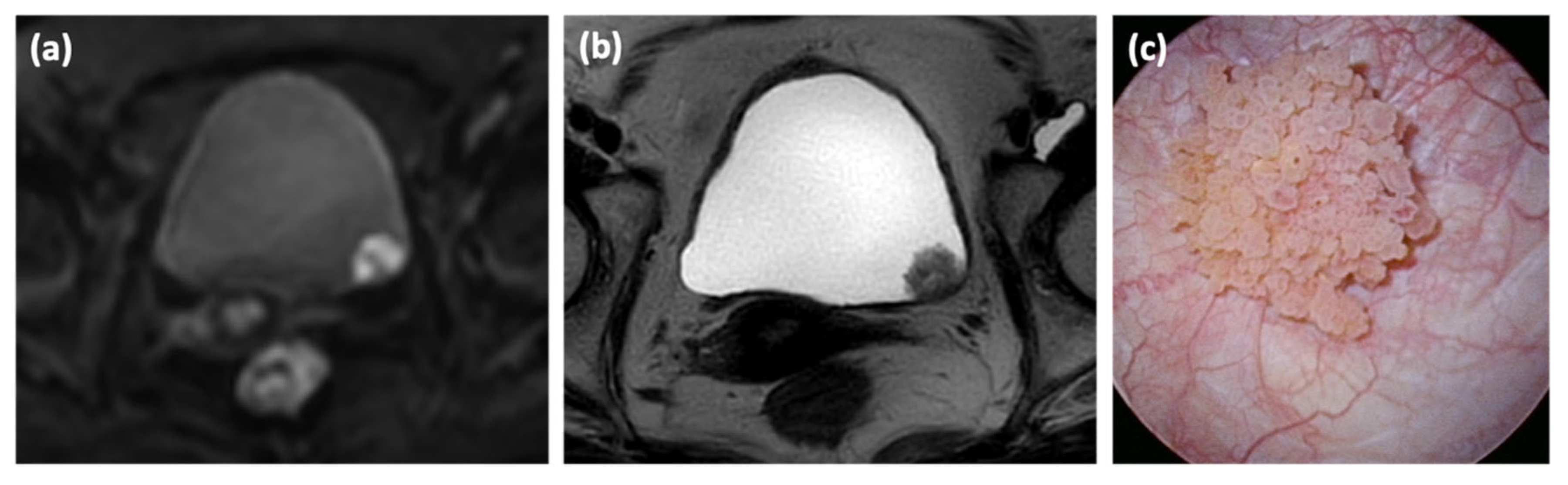 Cancers 14 05767 g001 Cancers 14 05767 g001