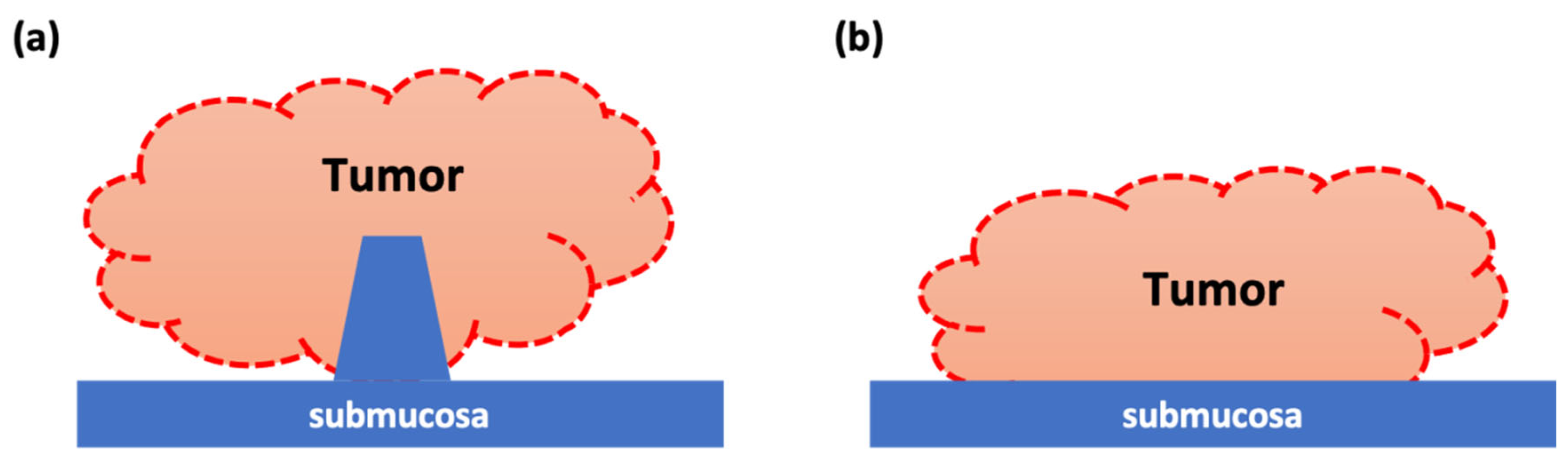 Cancers 14 05767 g005 Cancers 14 05767 g005