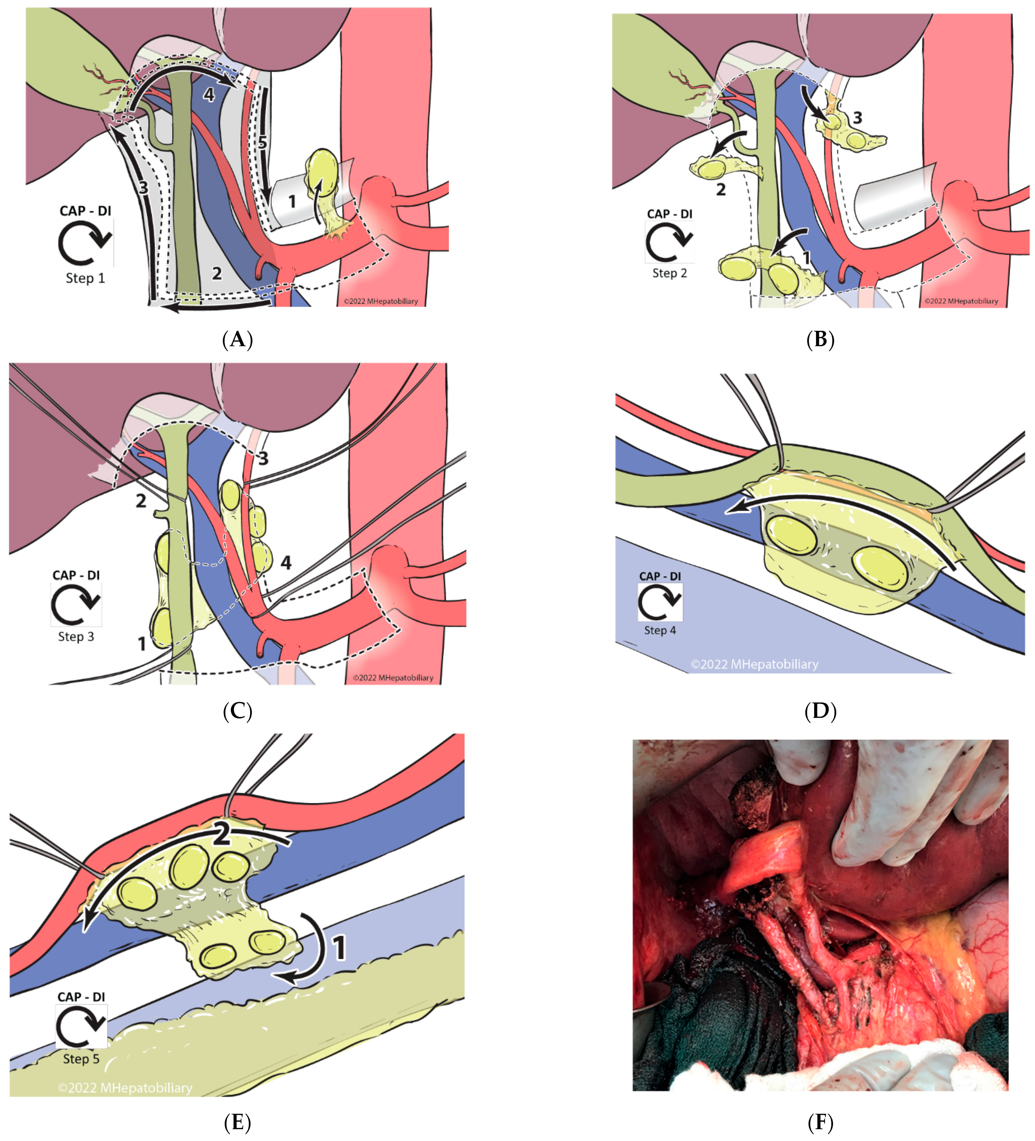 Cancers 14 05770 g002 Cancers 14 05770 g002