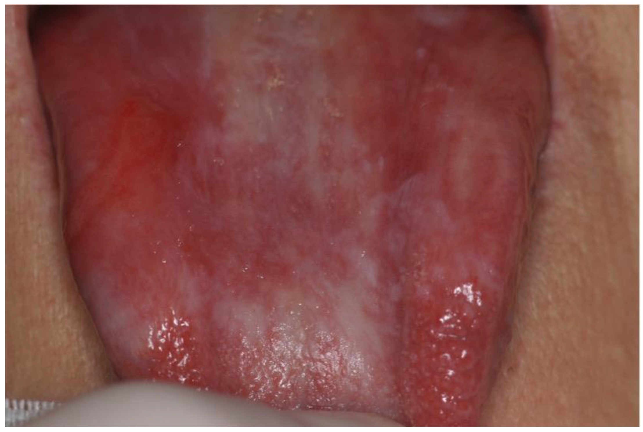 Cancers 14 05775 g001