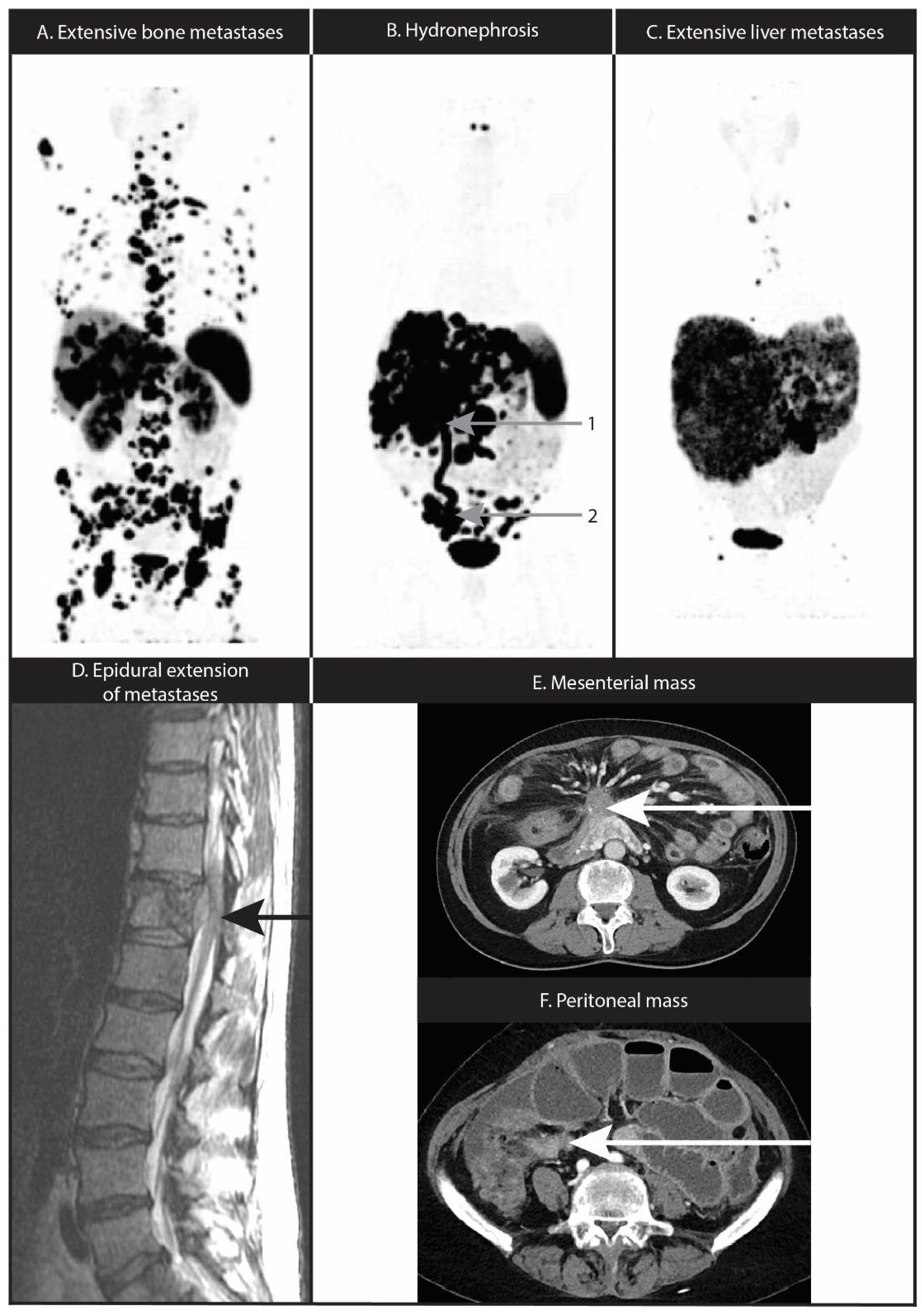 Cancers 14 05792 g002 Cancers 14 05792 g002