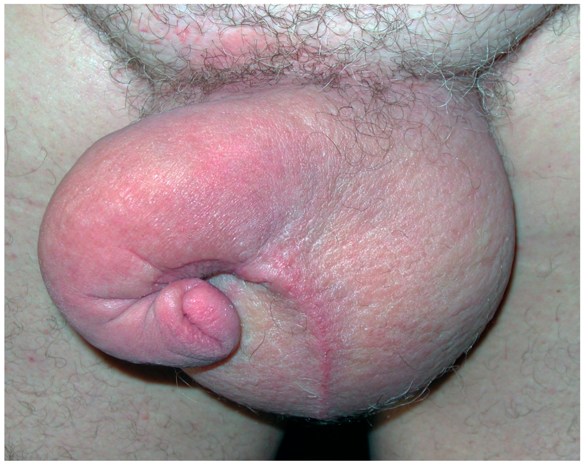 Cancers 14 05809 g002 Cancers 14 05809 g002