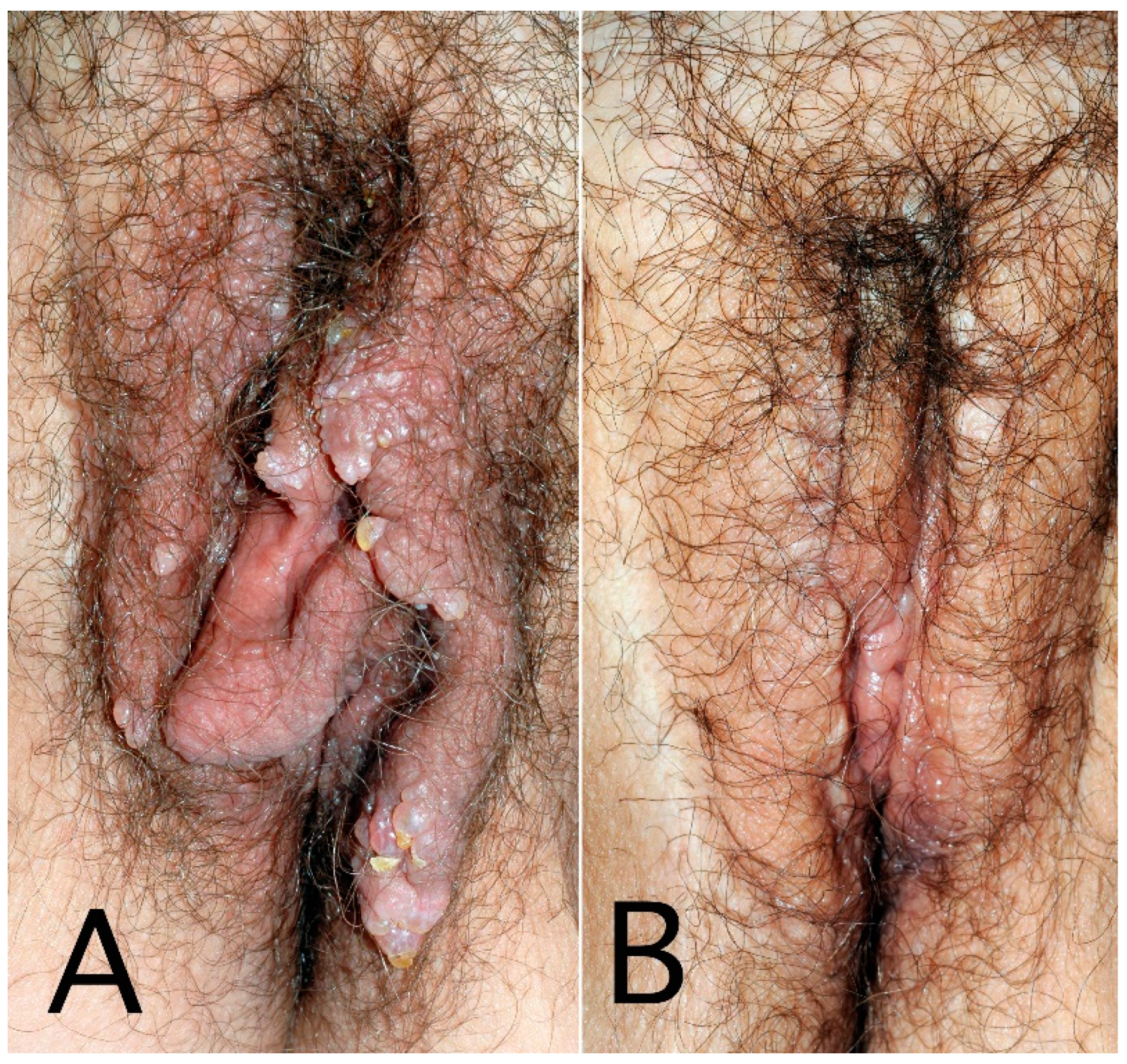 Cancers 14 05809 g003 Cancers 14 05809 g003