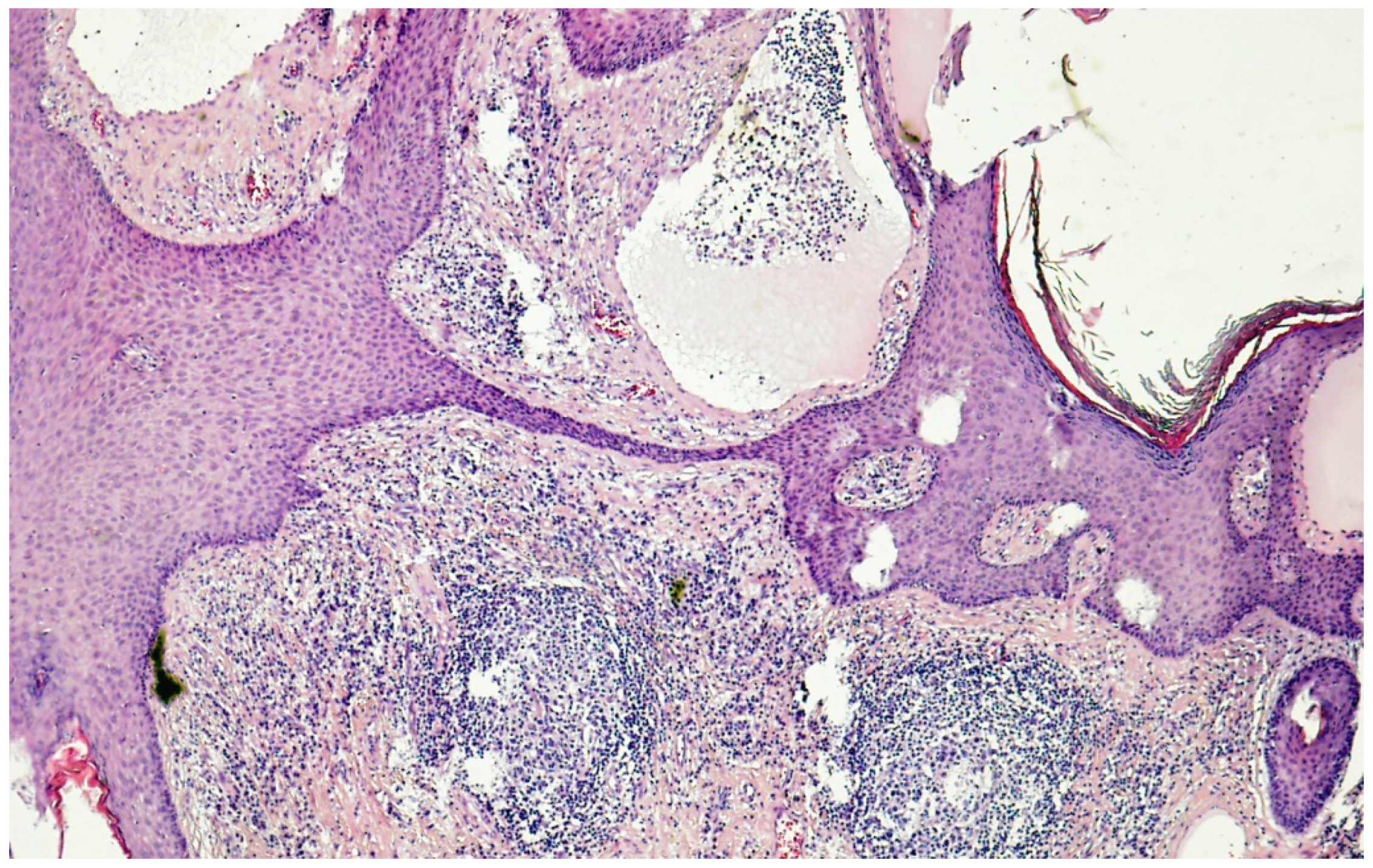 Cancers 14 05809 g004 Cancers 14 05809 g004