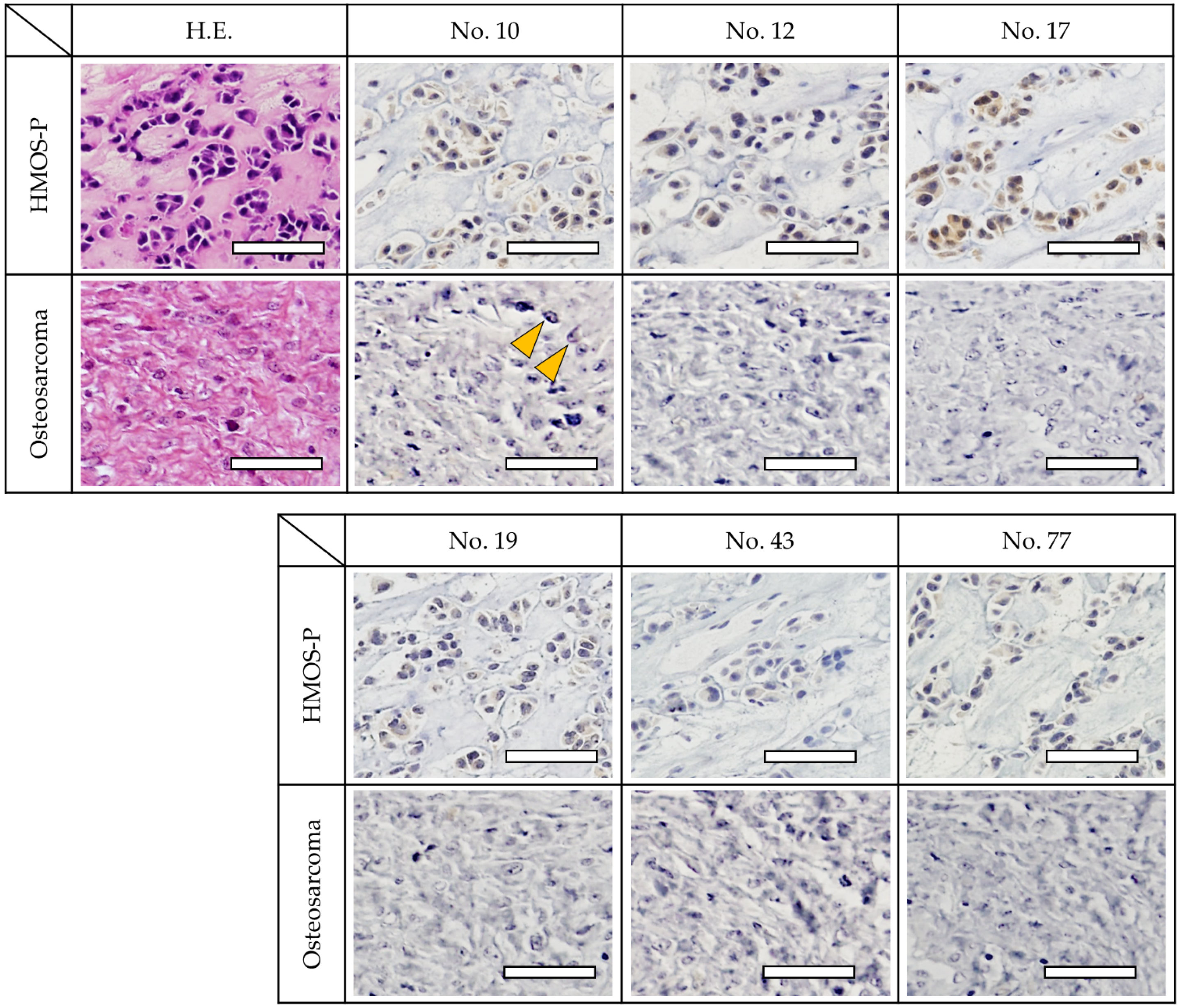 Cancers 14 05829 g004 Cancers 14 05829 g004