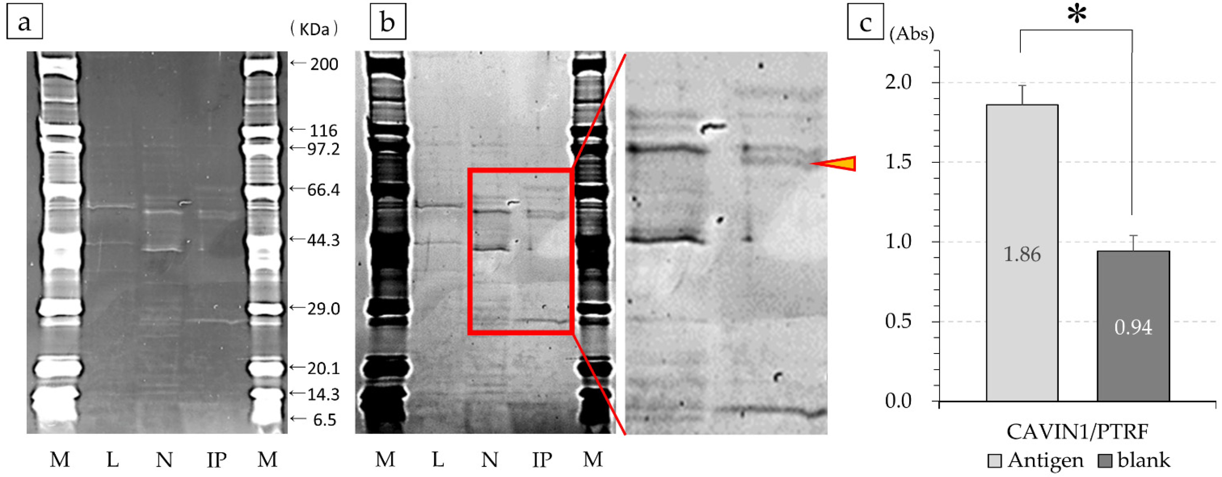 Cancers 14 05829 g005 Cancers 14 05829 g005