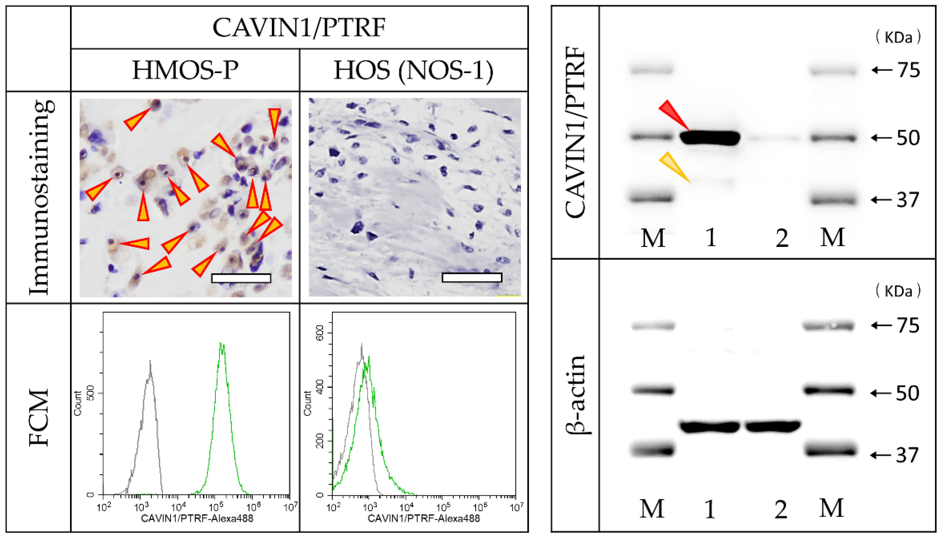 Cancers 14 05829 g006 Cancers 14 05829 g006
