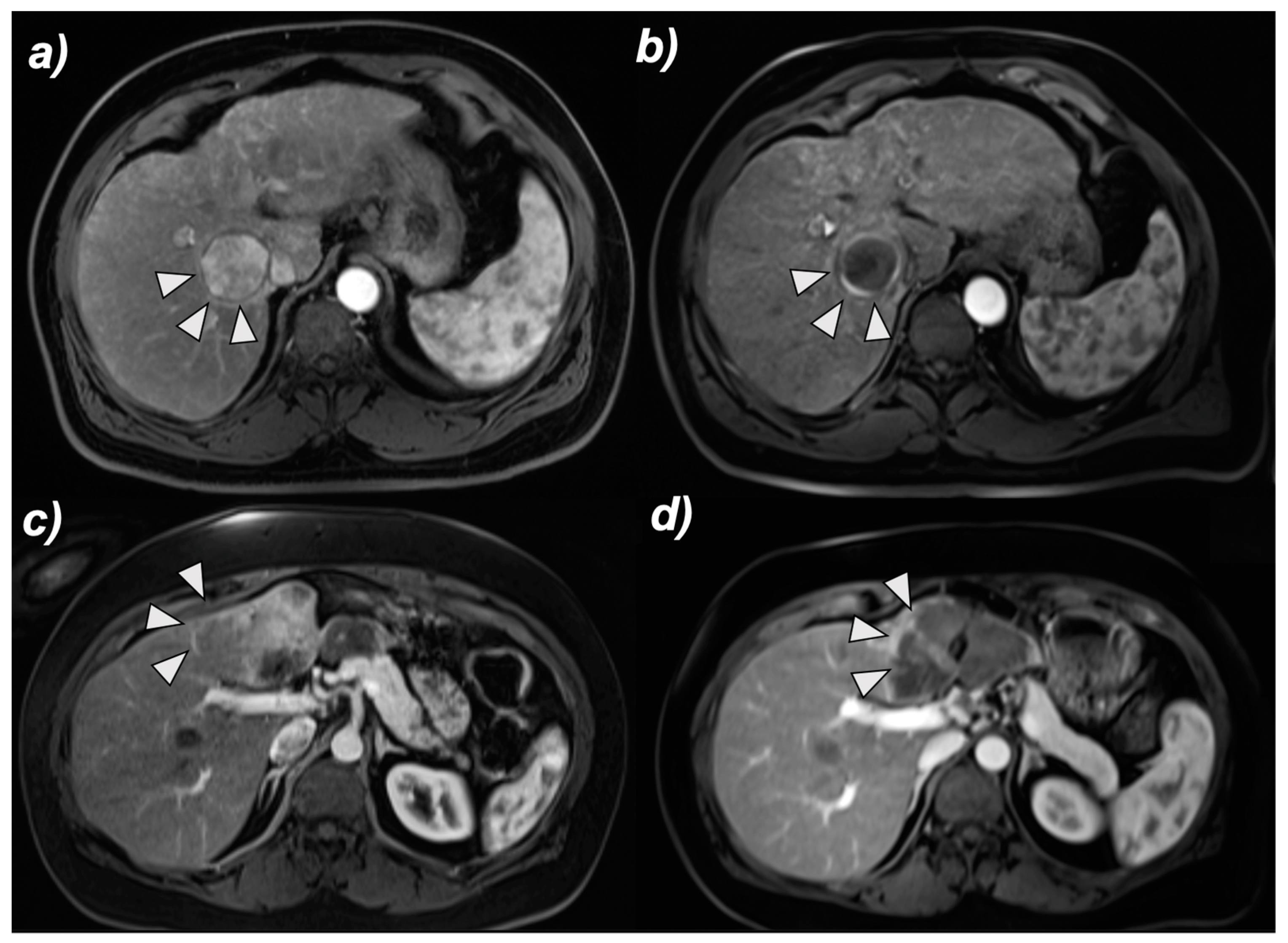 Cancers 14 05847 g004 Cancers 14 05847 g004