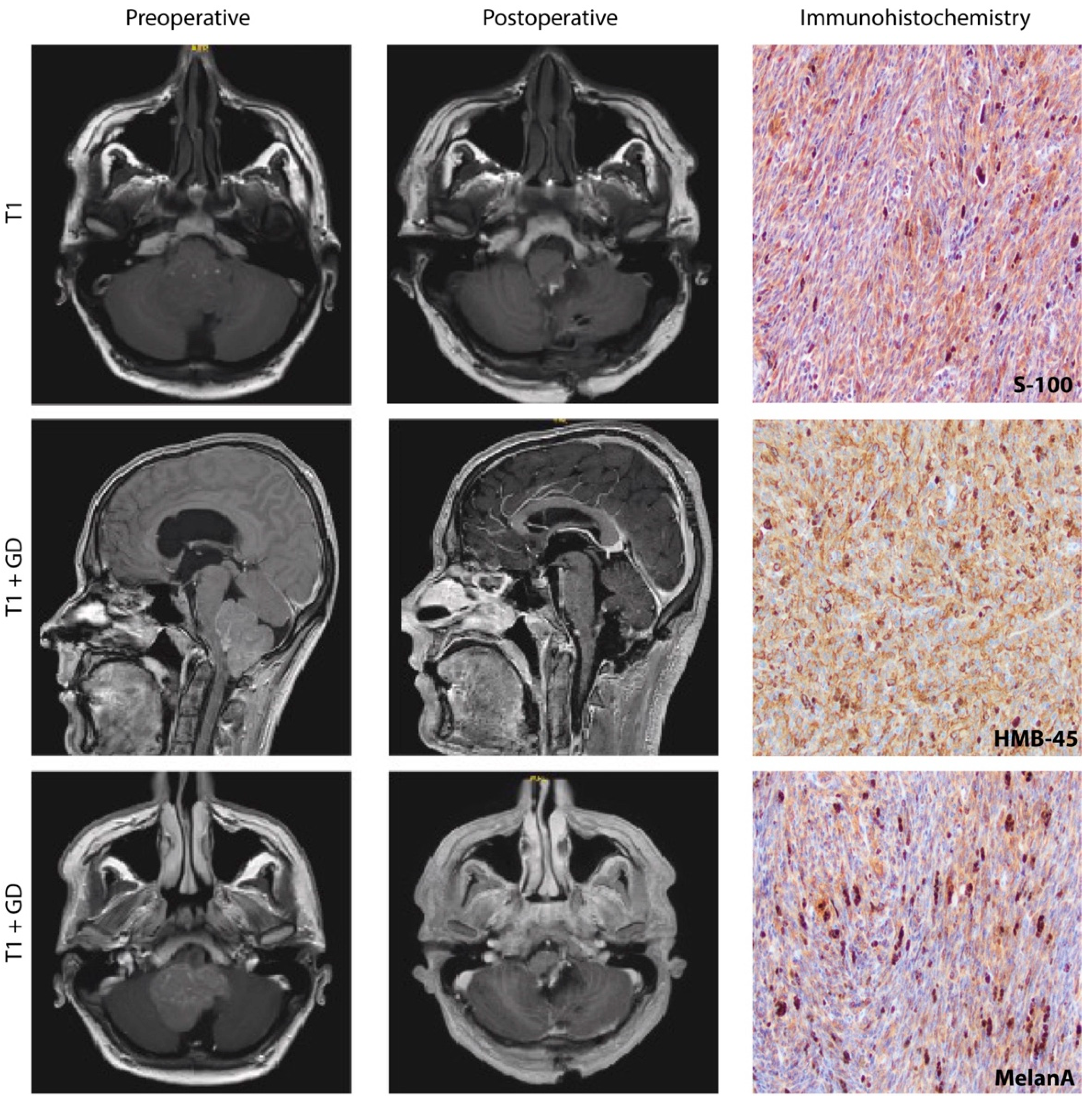 Cancers 14 05851 g001 Cancers 14 05851 g001