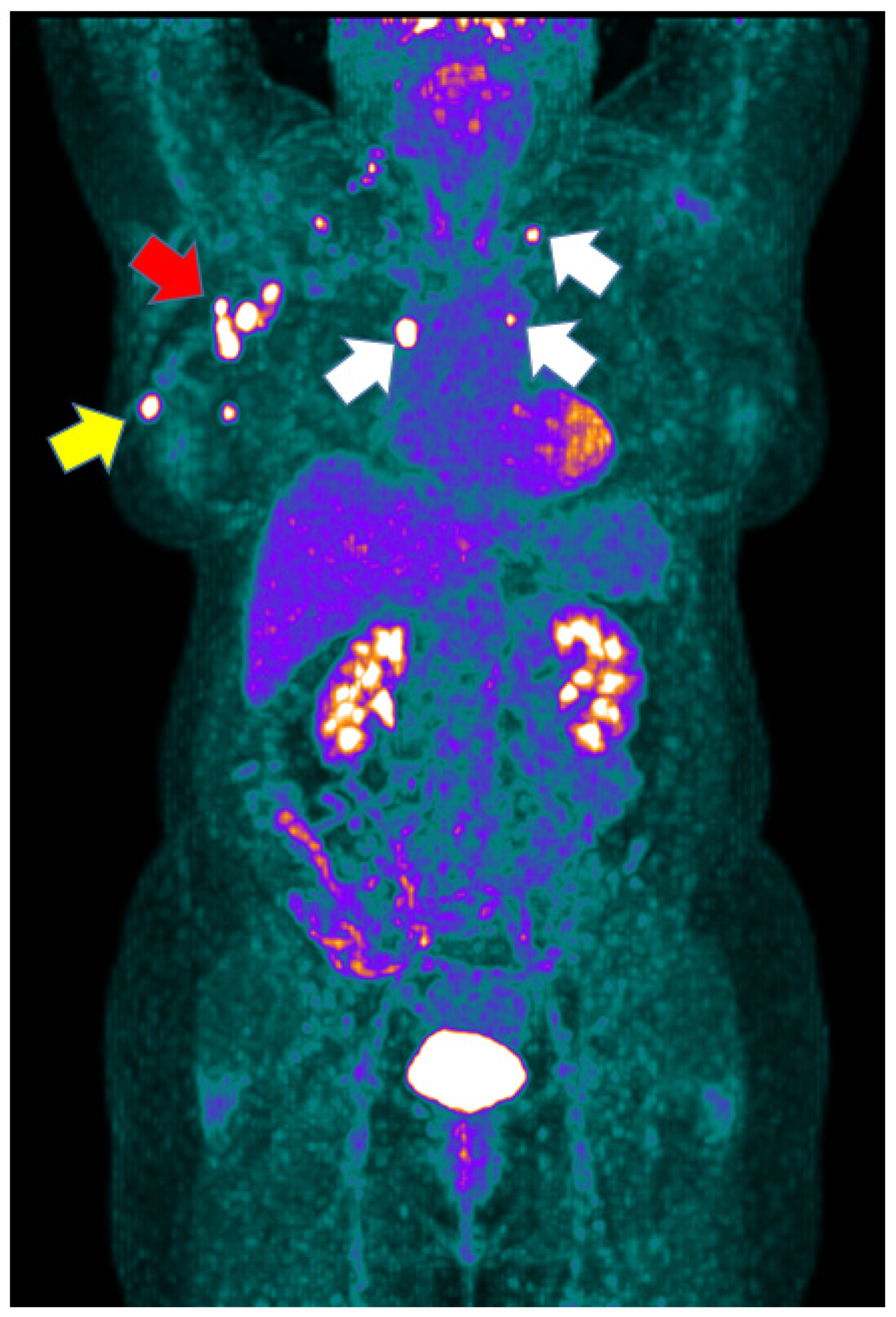 Cancers 14 05869 g004 Cancers 14 05869 g004