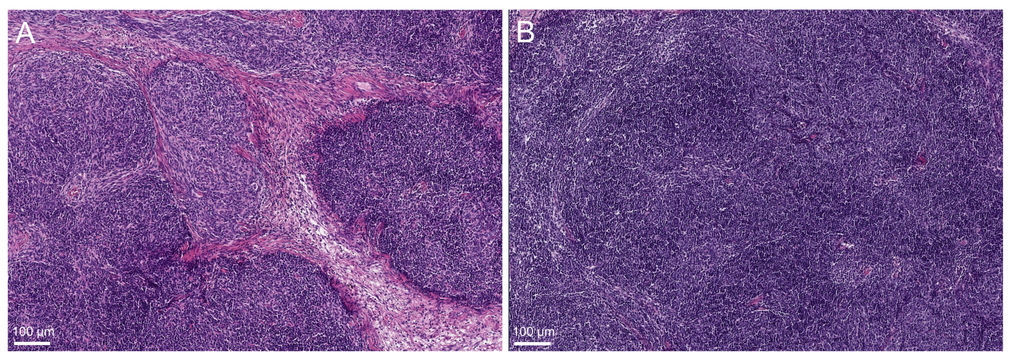 Cancers 14 05876 g002 Cancers 14 05876 g002