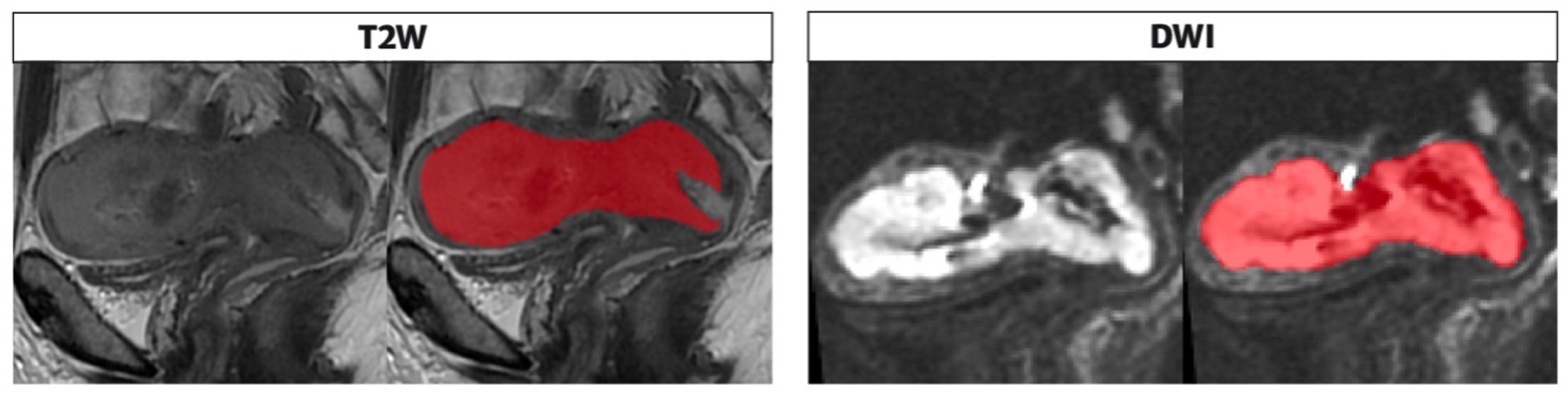 Cancers 14 05881 g003