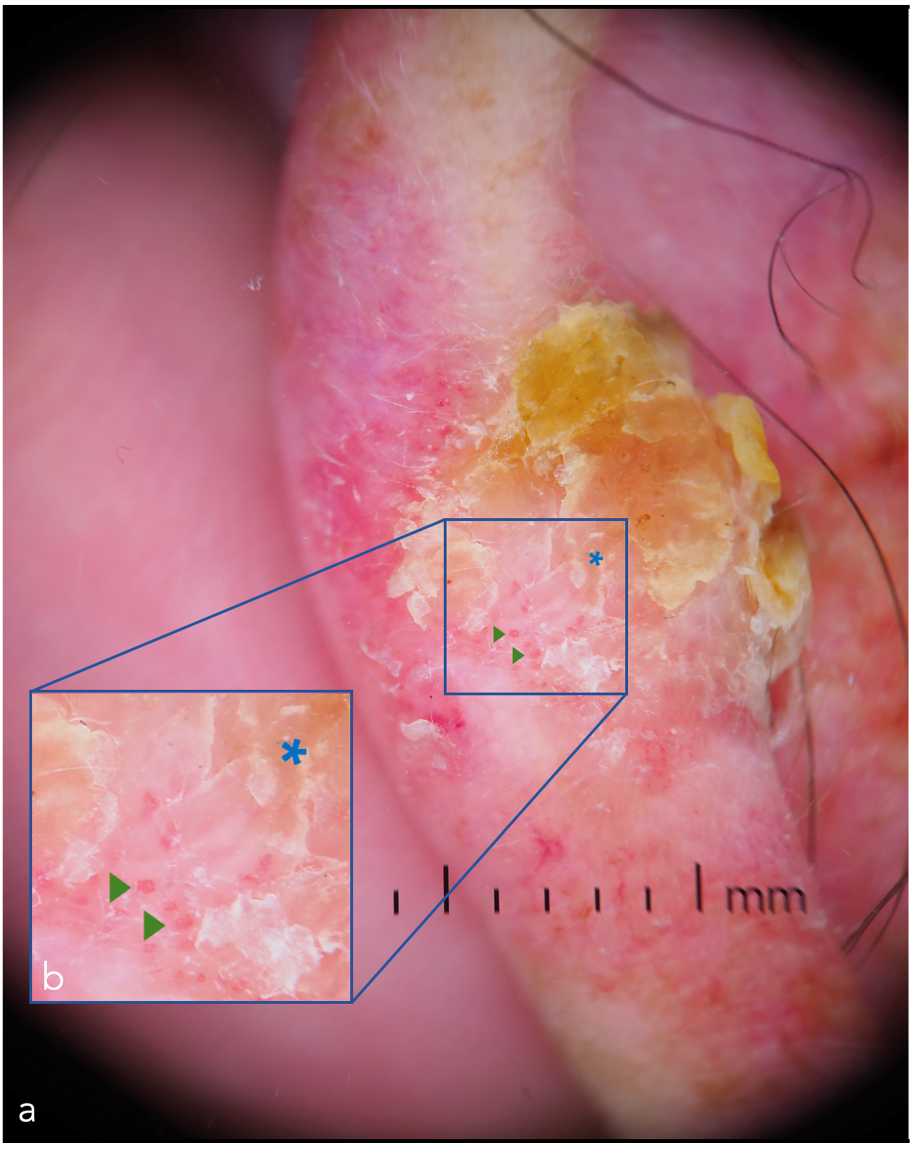 Cancers 14 05886 g005