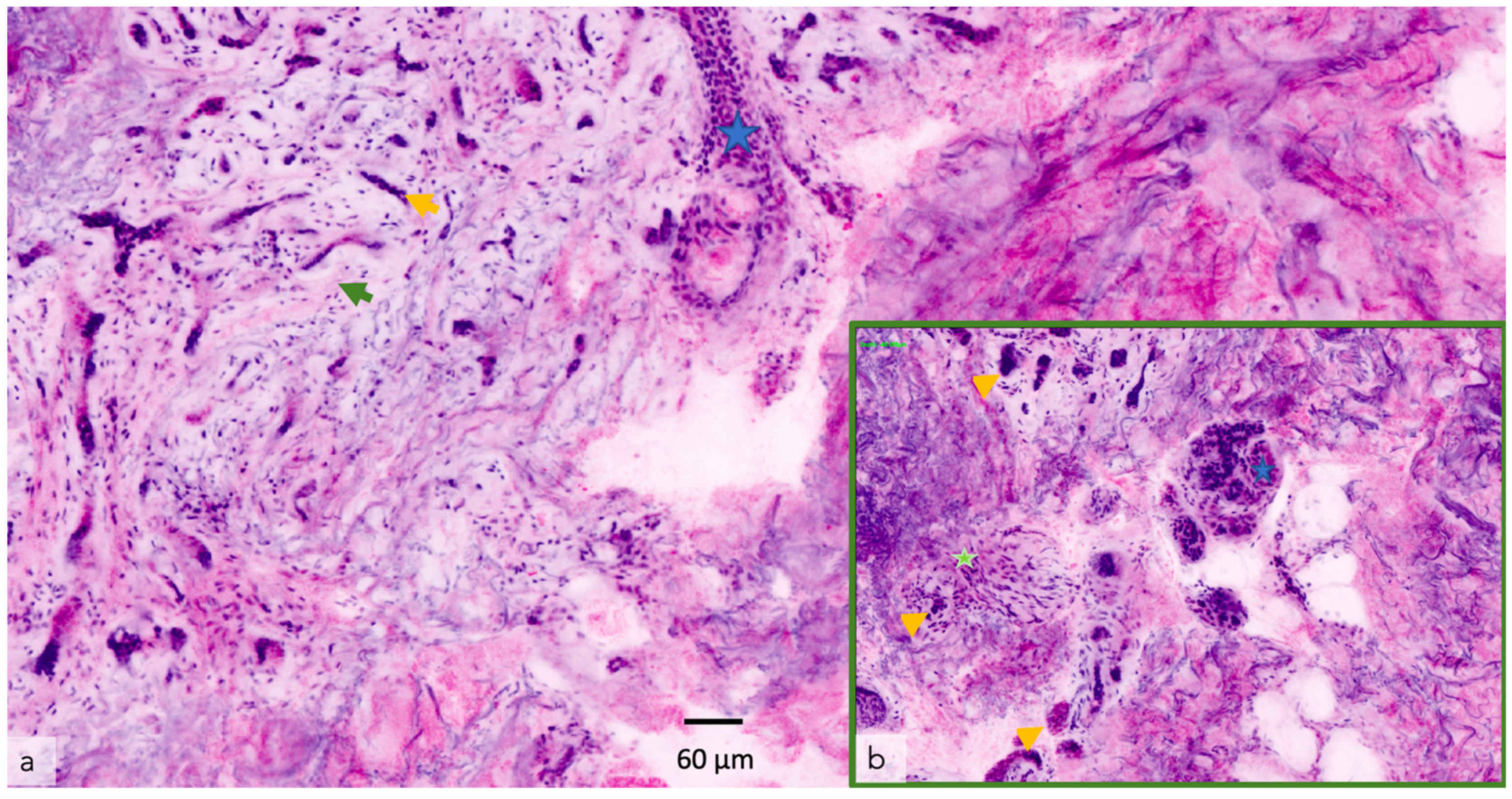 Cancers 14 05886 g009