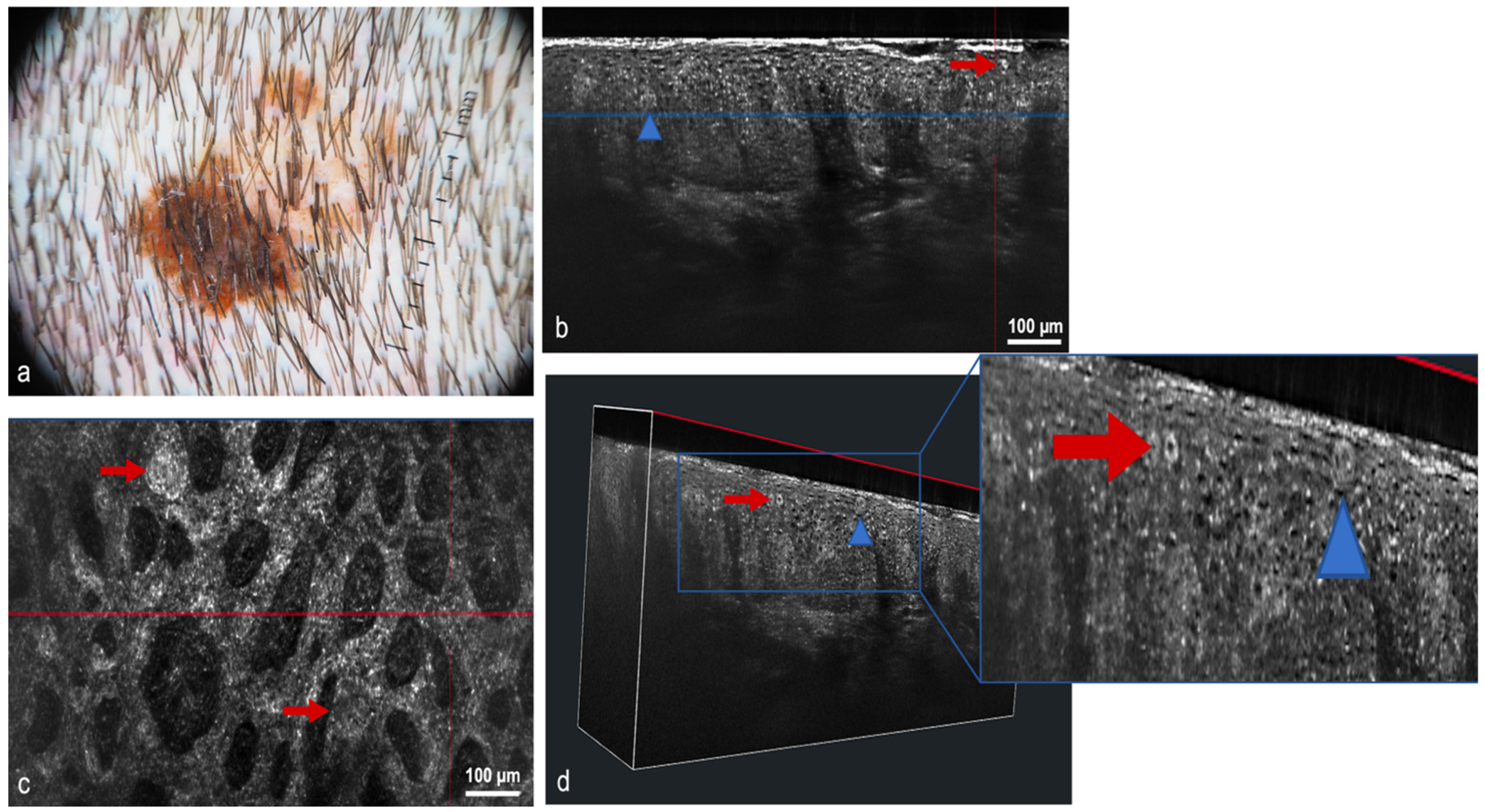 Cancers 14 05886 g011