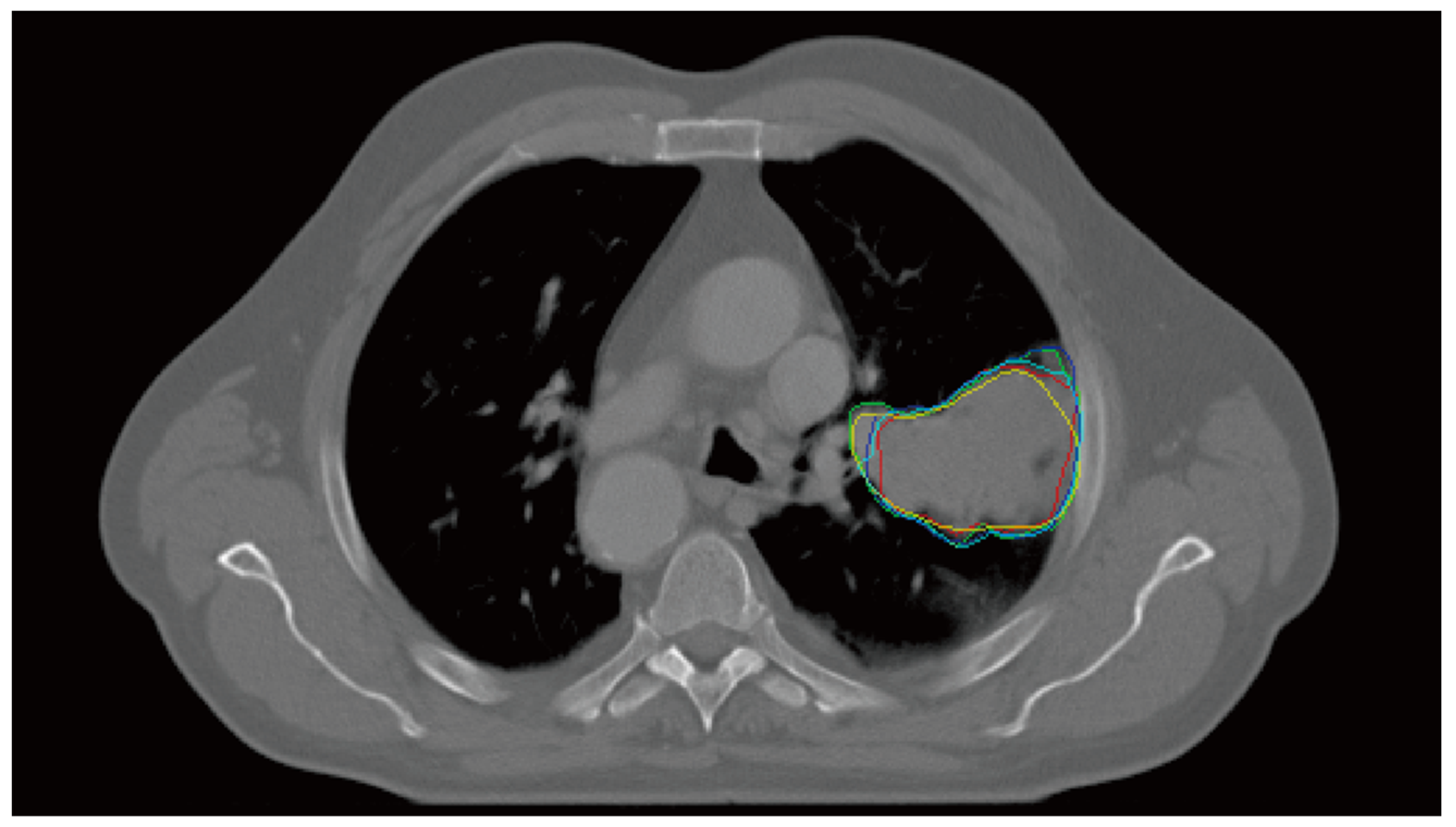 Cancers 14 05893 g001 Cancers 14 05893 g001