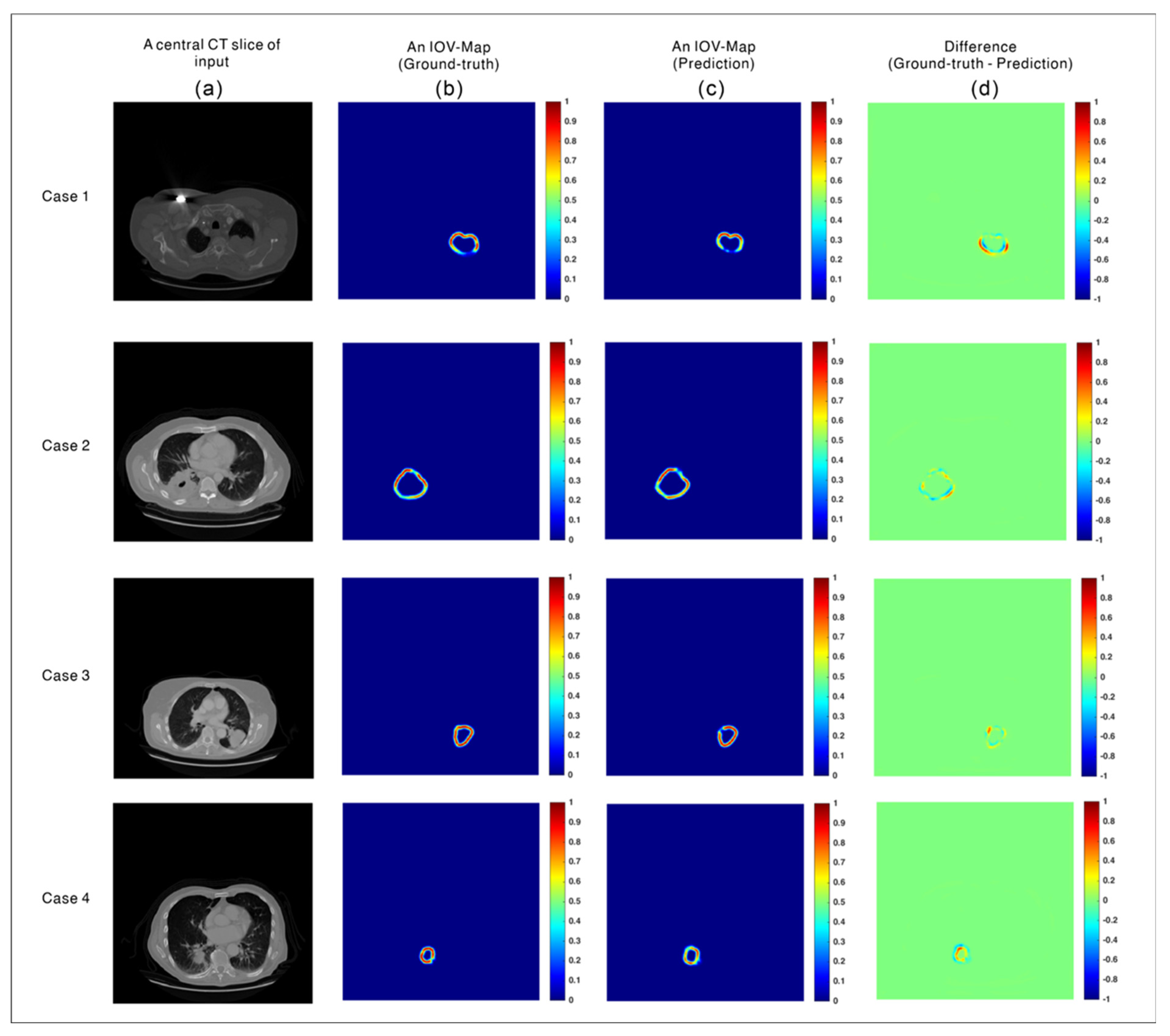 Cancers 14 05893 g004 Cancers 14 05893 g004