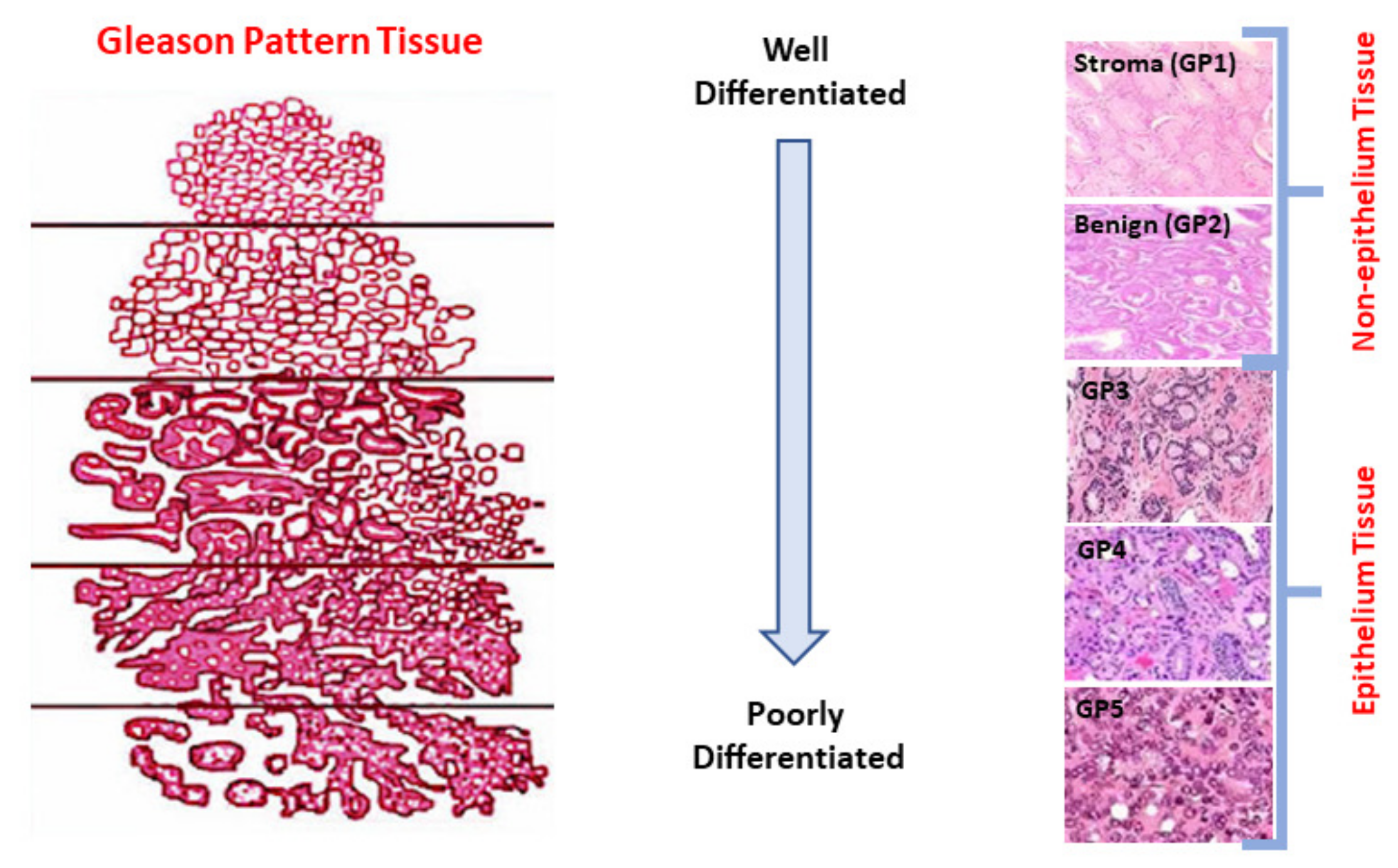 Cancers Free FullText MultiStage ClassificationBased Deep